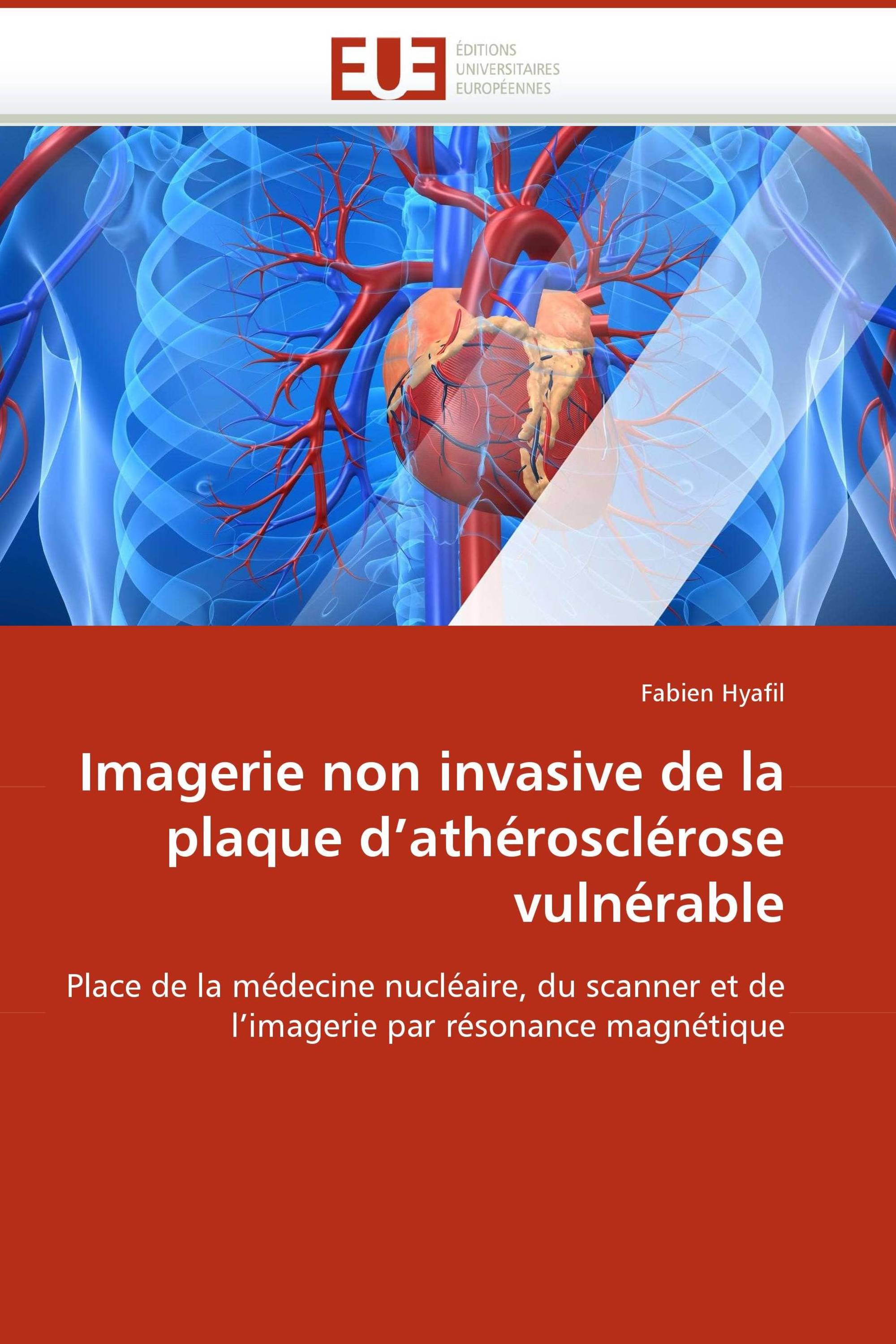 Imagerie non invasive de la plaque d''athérosclérose vulnérable