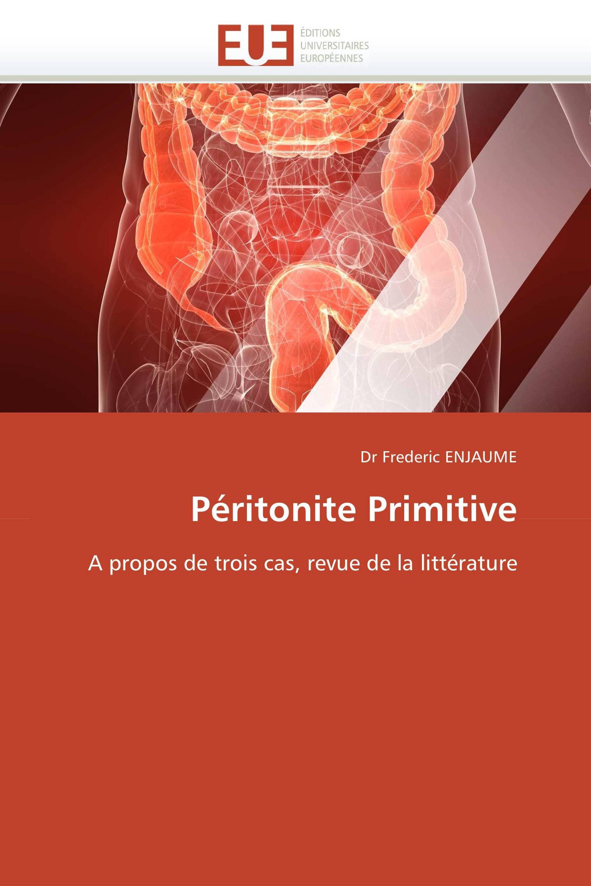 Péritonite Primitive