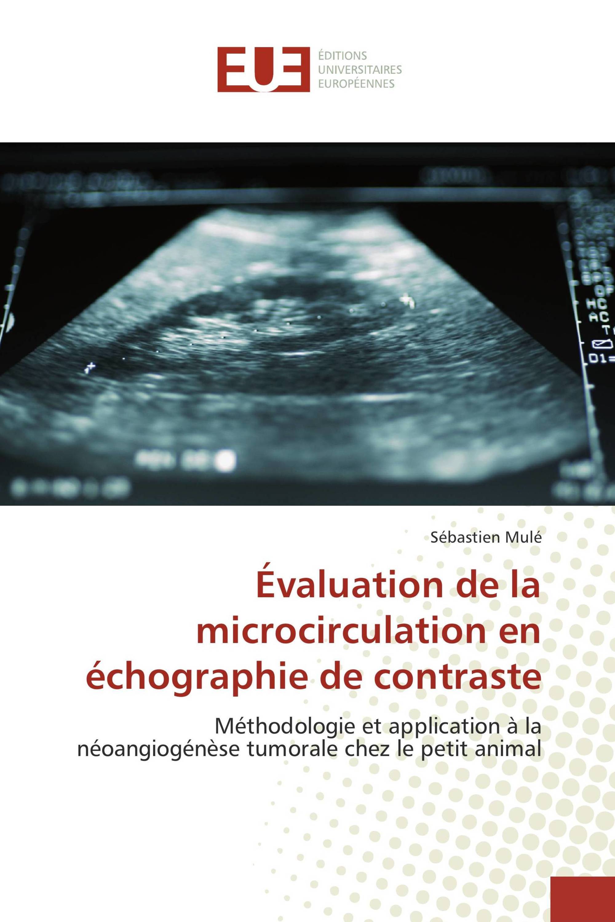 Évaluation de la microcirculation en échographie de contraste