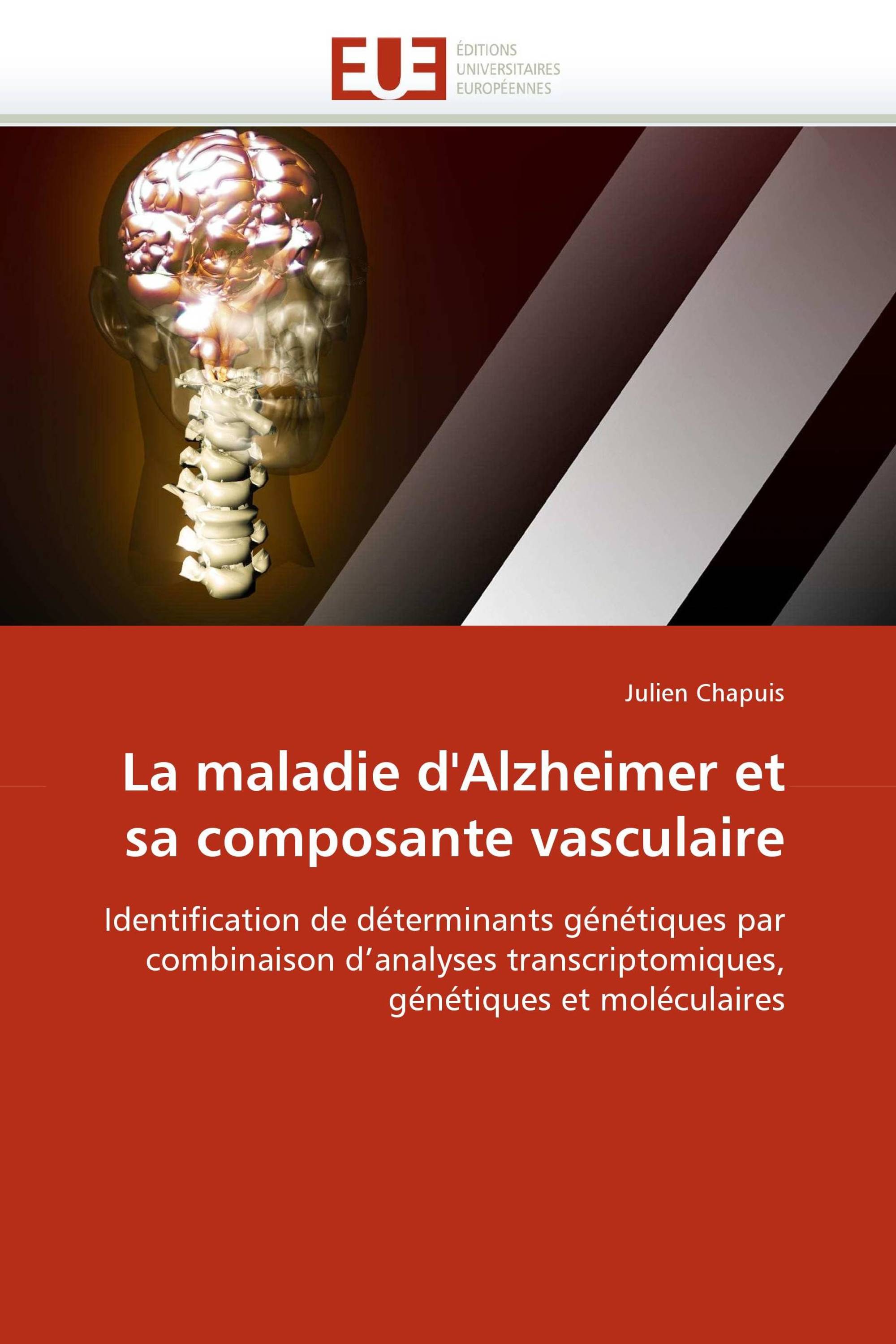 La maladie d''Alzheimer et sa composante vasculaire