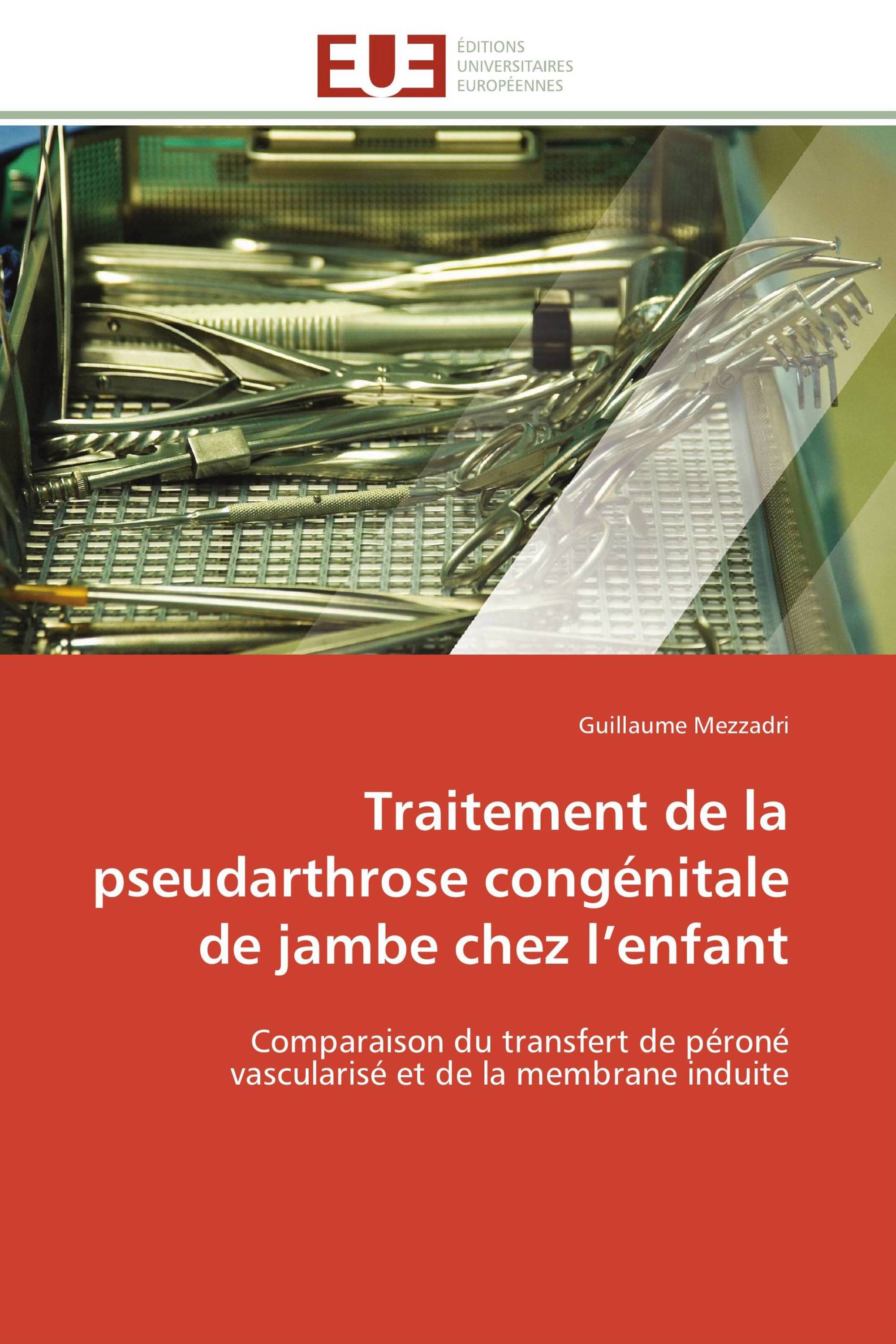 Traitement de la pseudarthrose congénitale de jambe chez l’enfant