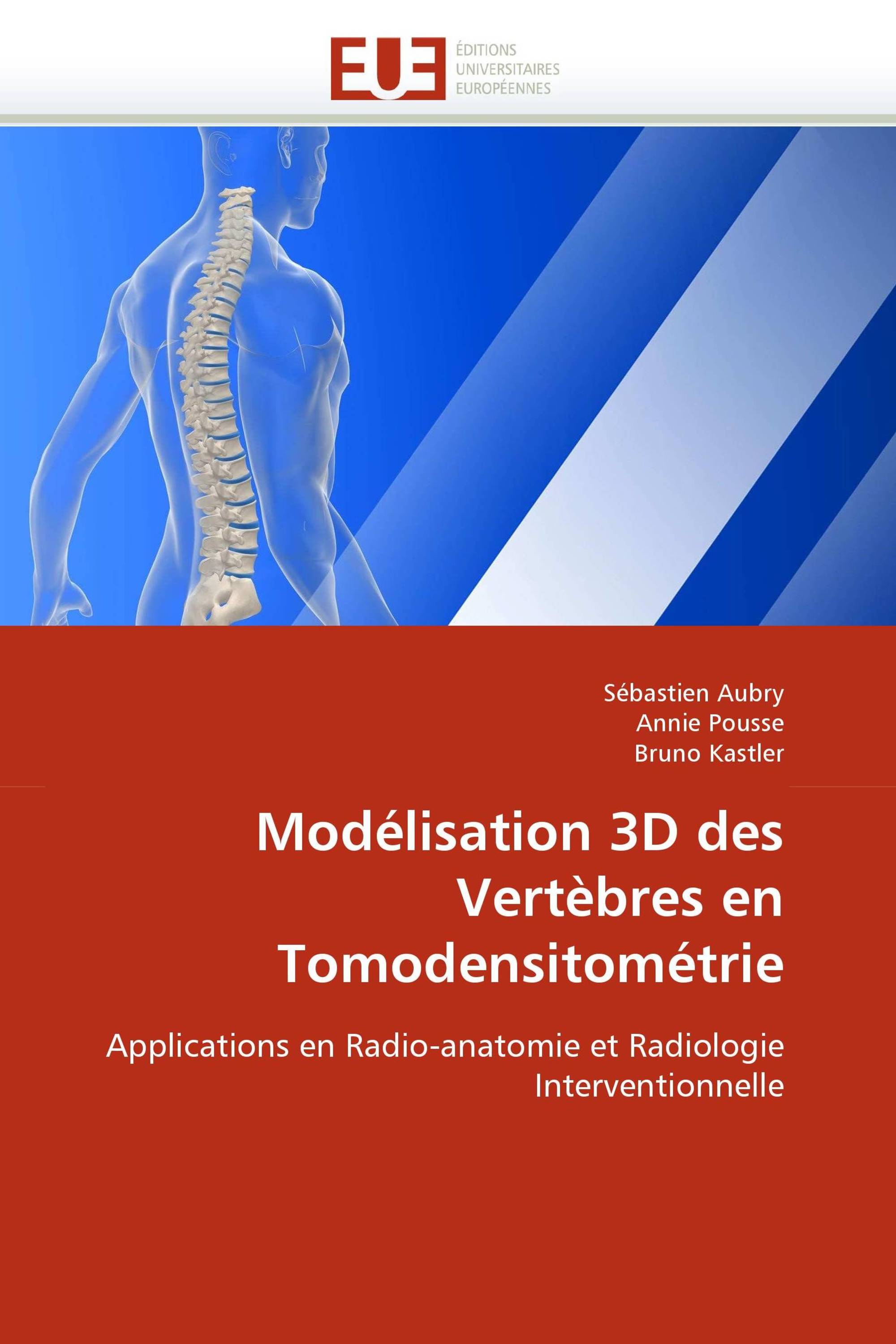 Modélisation 3D des Vertèbres en Tomodensitométrie