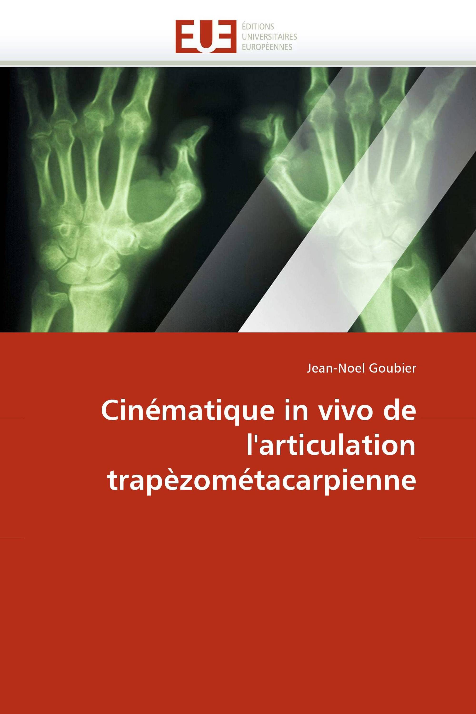 Cinématique in vivo de l''articulation trapèzométacarpienne