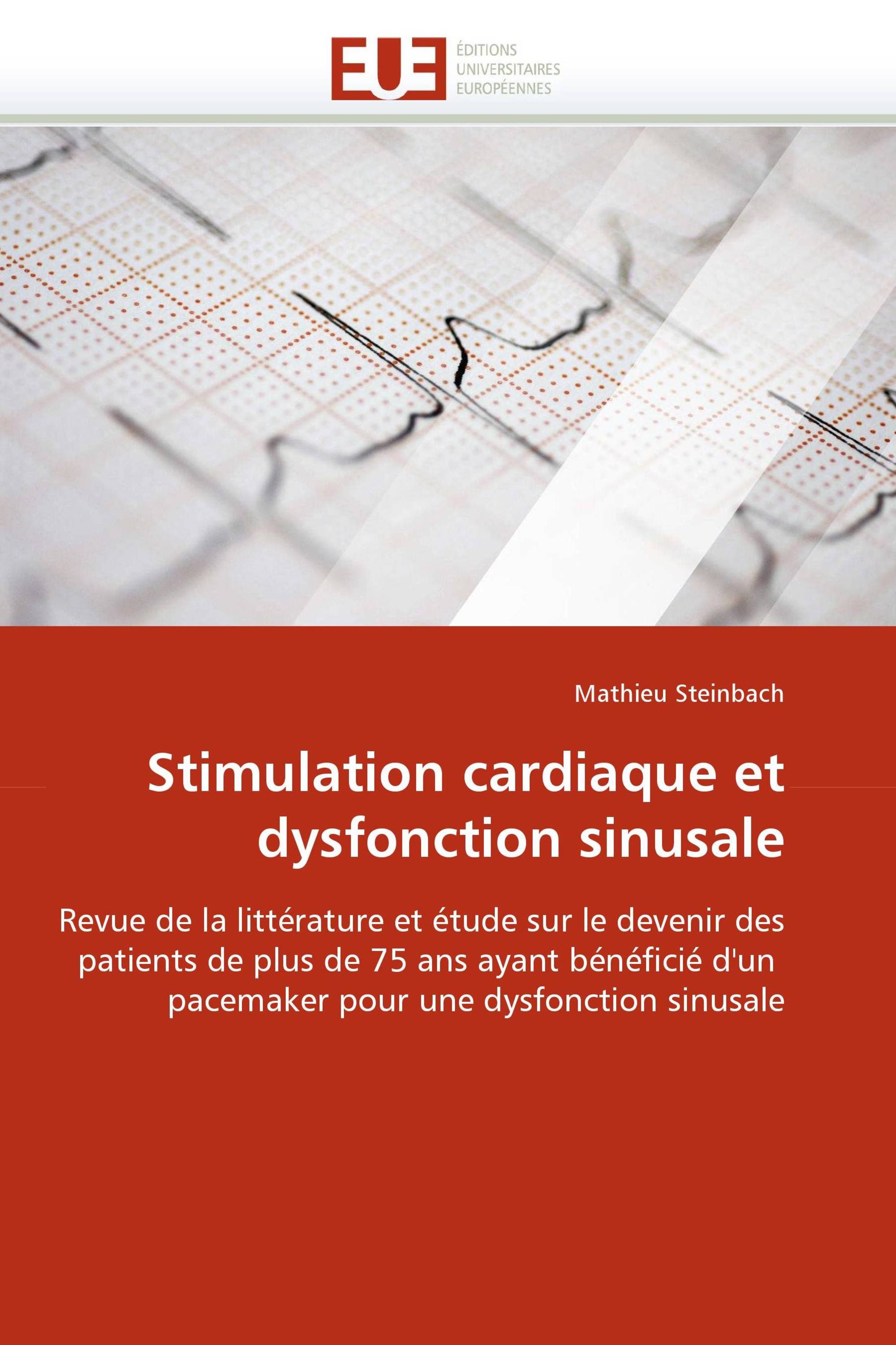 Stimulation cardiaque et dysfonction sinusale