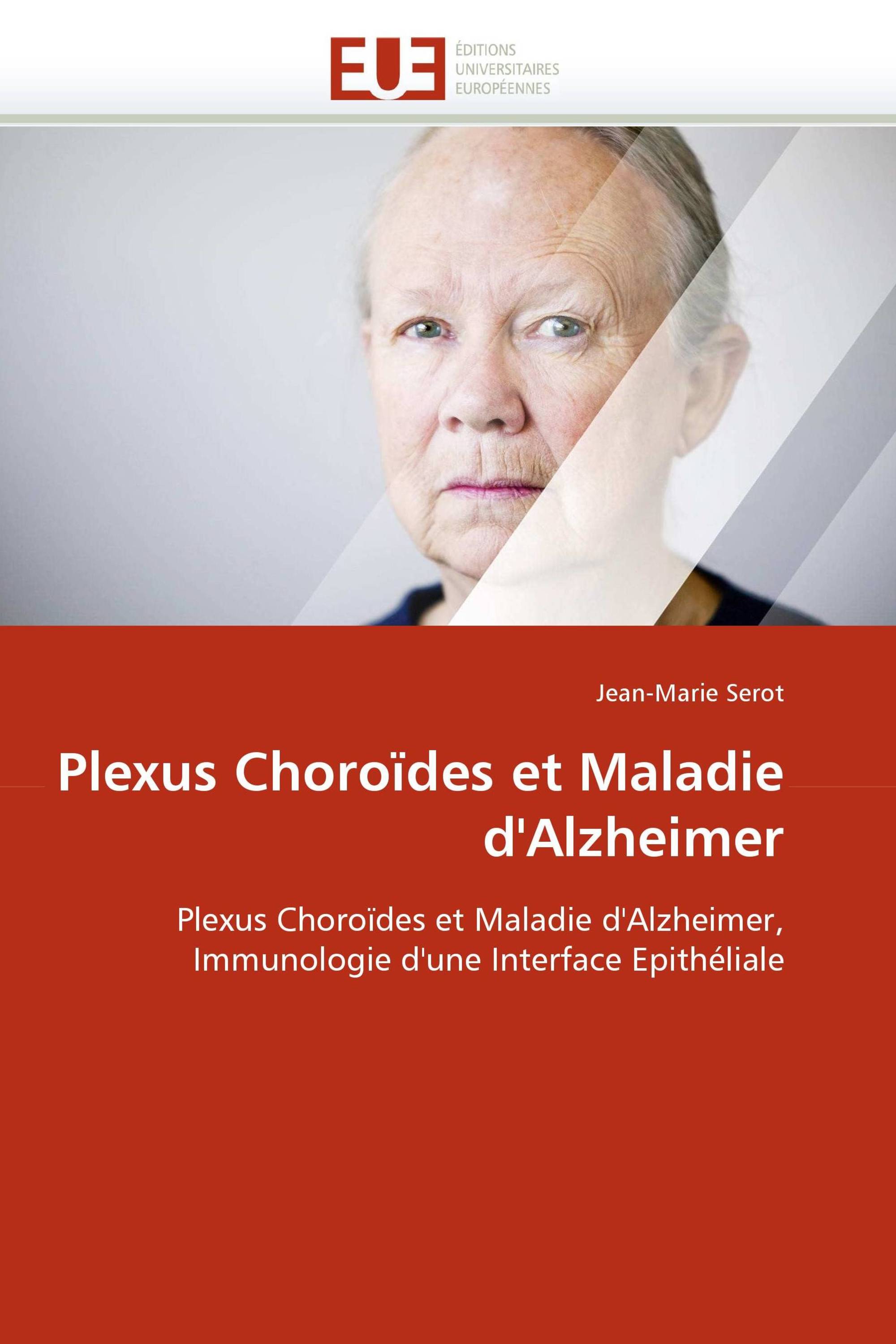 Plexus Choroïdes et Maladie d'Alzheimer