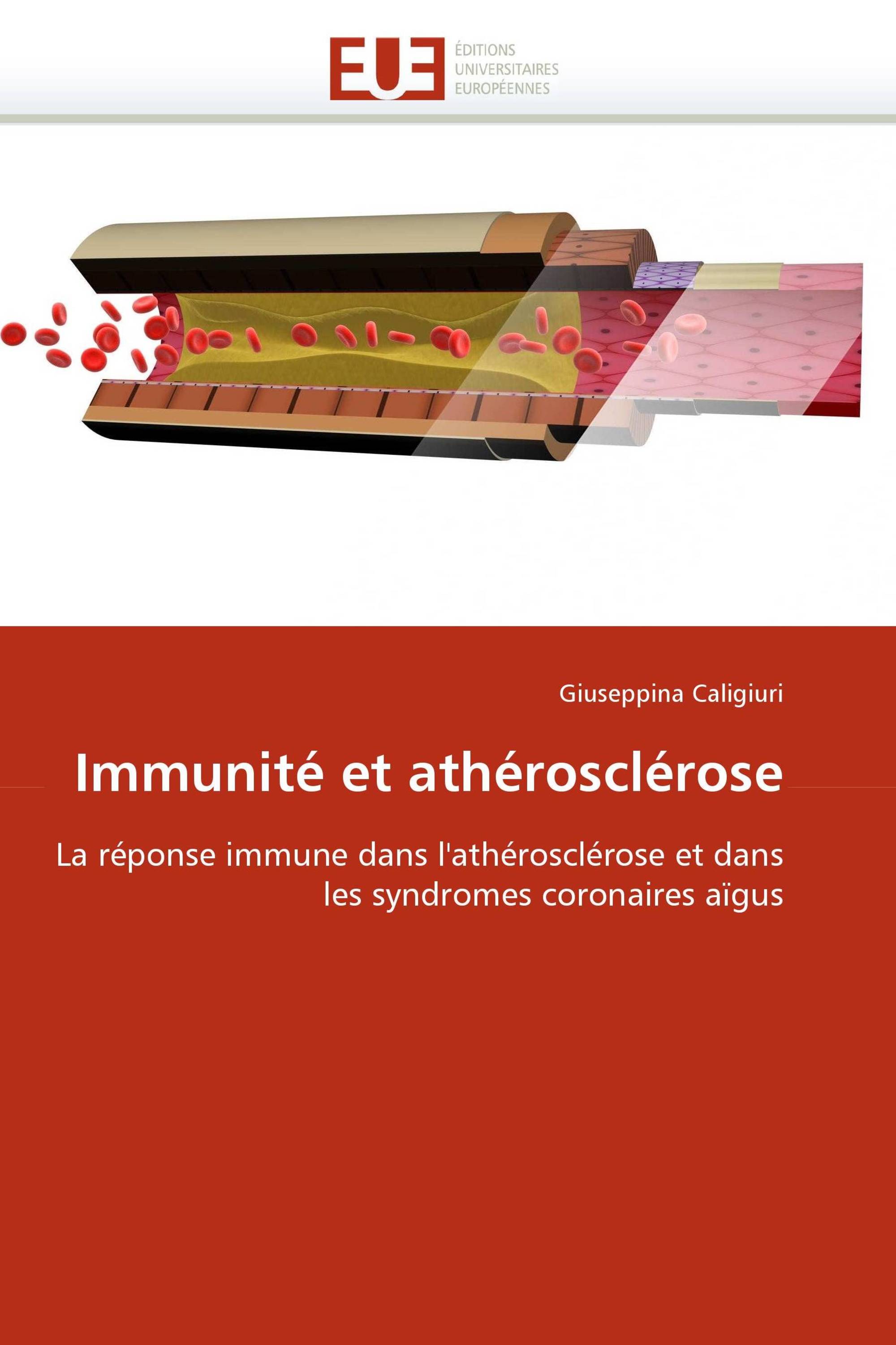 Immunité et athérosclérose