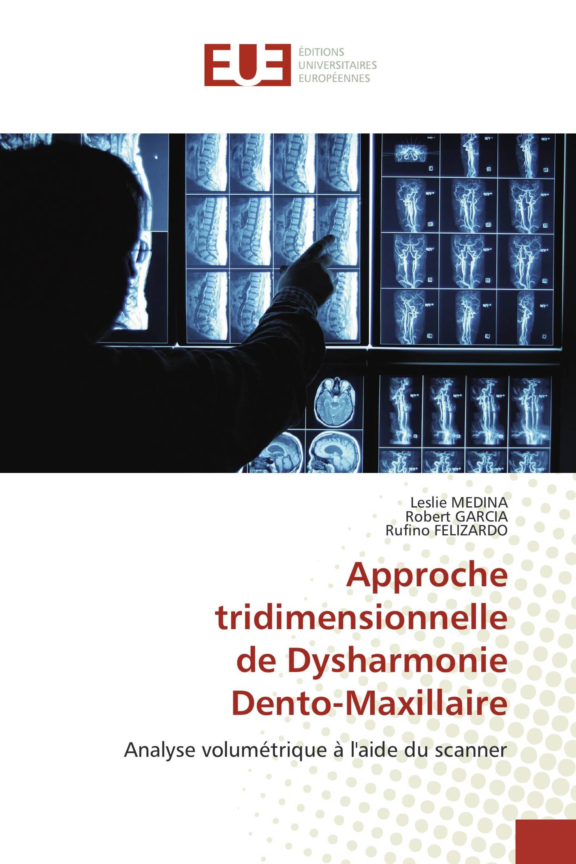 Approche tridimensionnelle de Dysharmonie Dento-Maxillaire