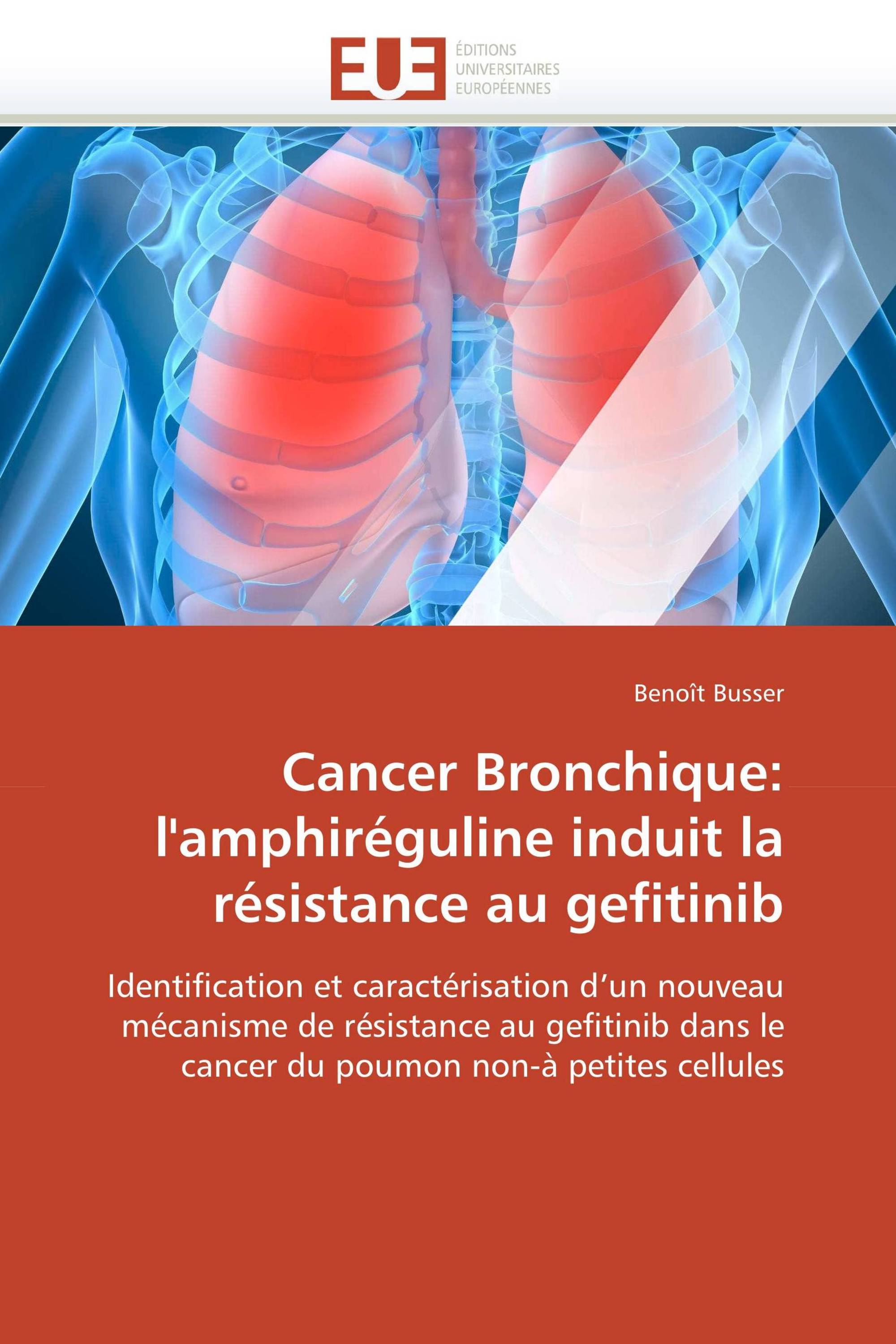 Cancer Bronchique: l'amphiréguline induit la résistance au gefitinib