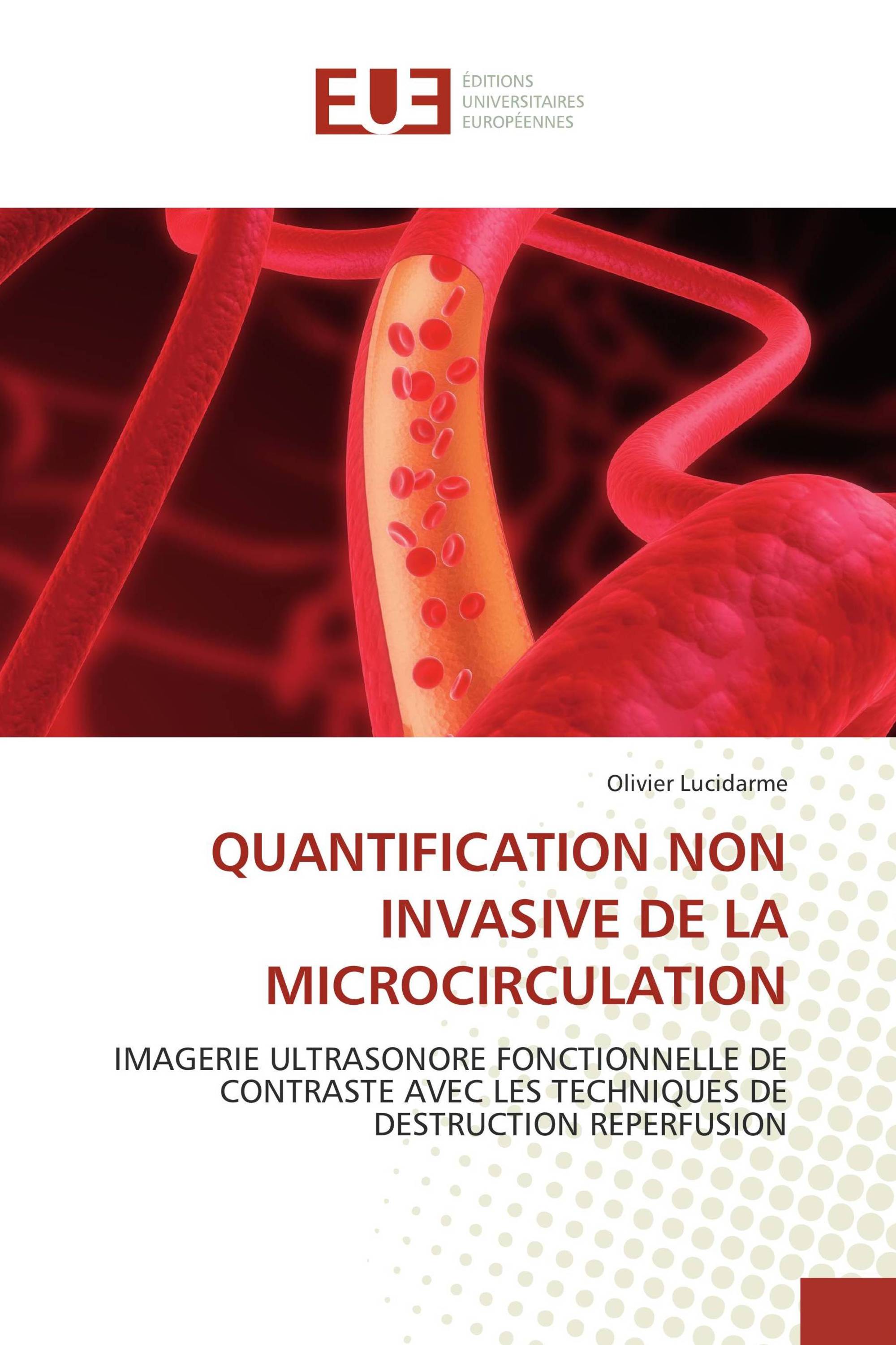 QUANTIFICATION NON INVASIVE DE LA MICROCIRCULATION