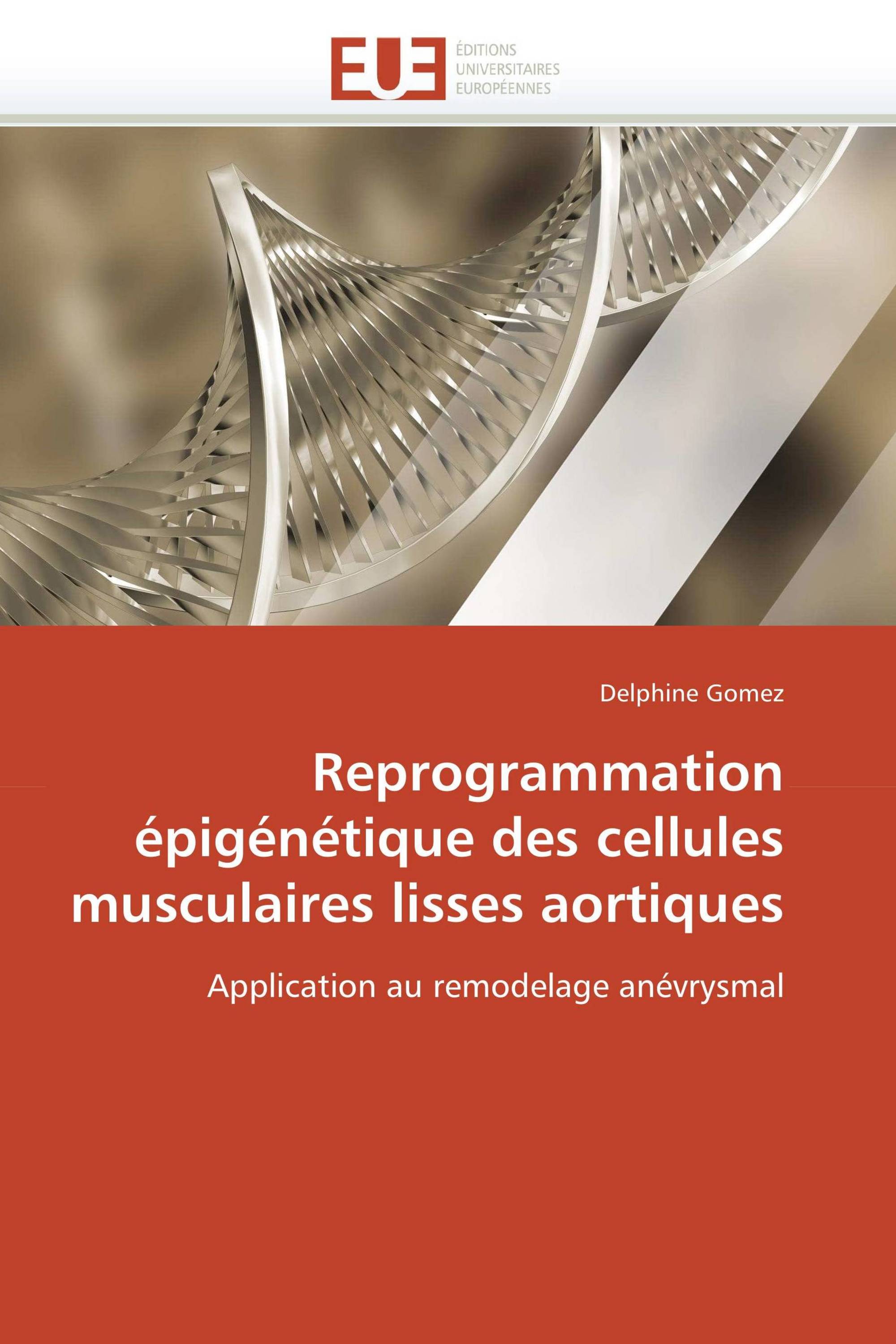 Reprogrammation épigénétique des cellules musculaires lisses aortiques