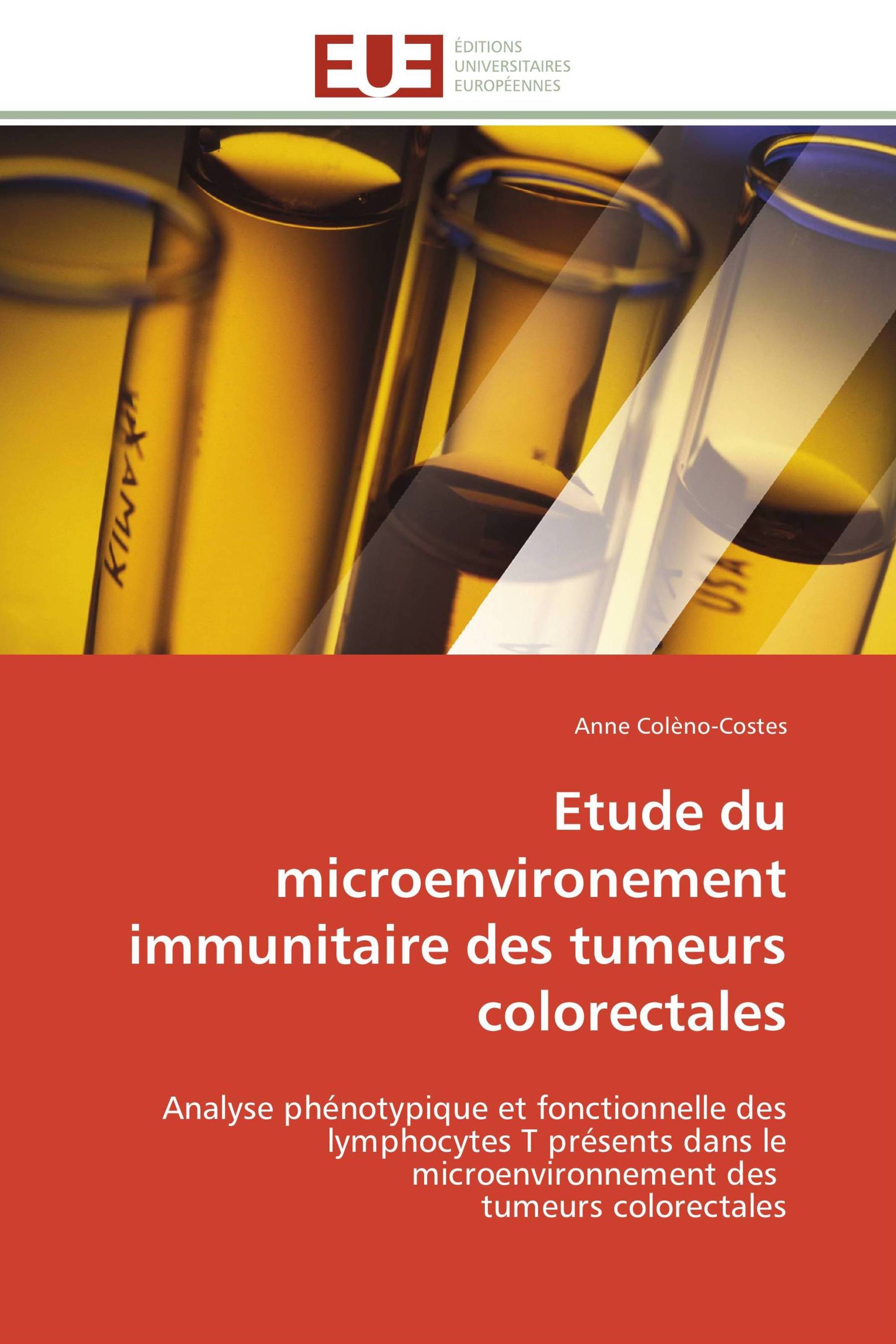 Etude du microenvironement immunitaire des tumeurs colorectales