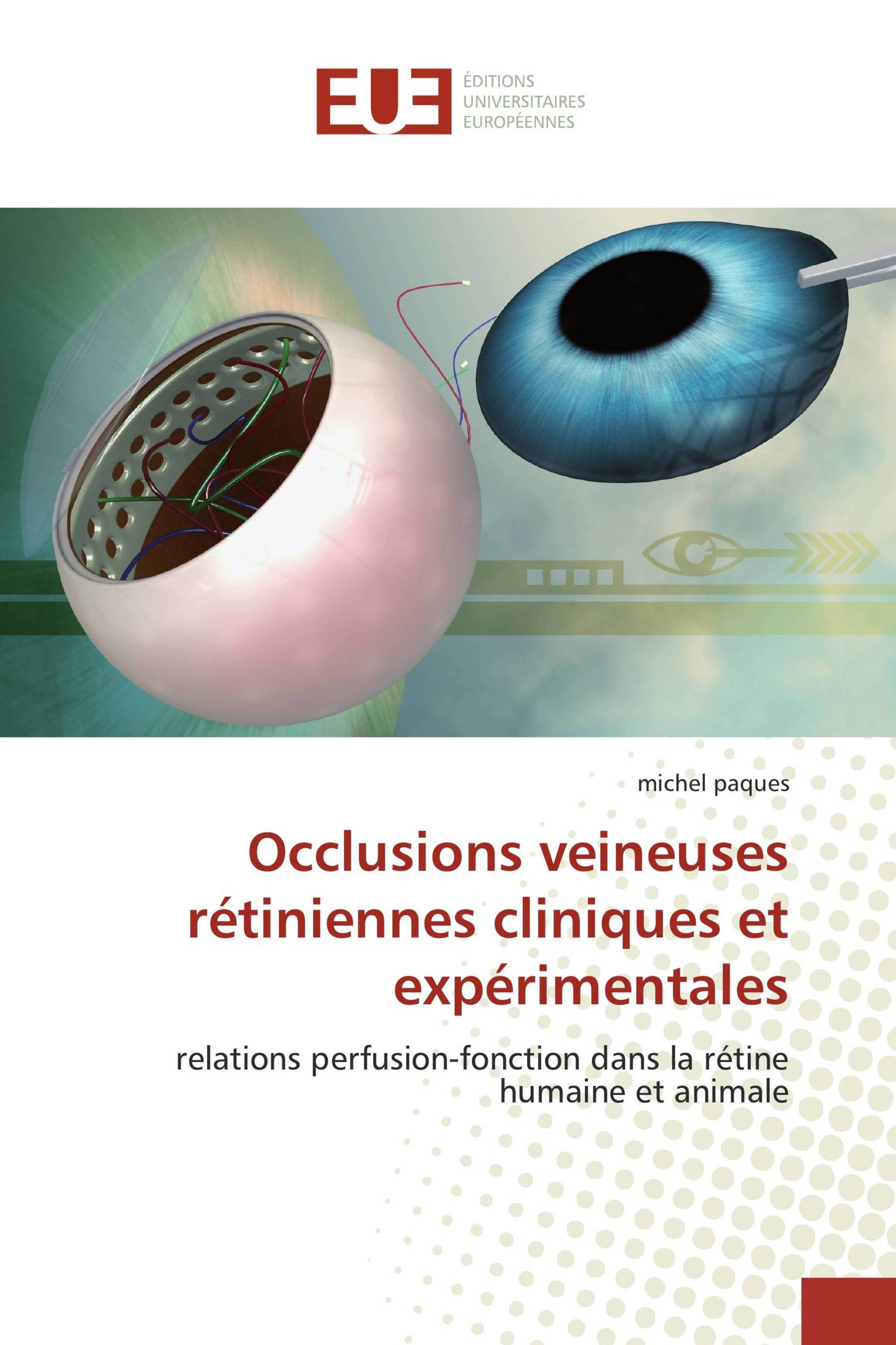 Occlusions veineuses rétiniennes cliniques et expérimentales