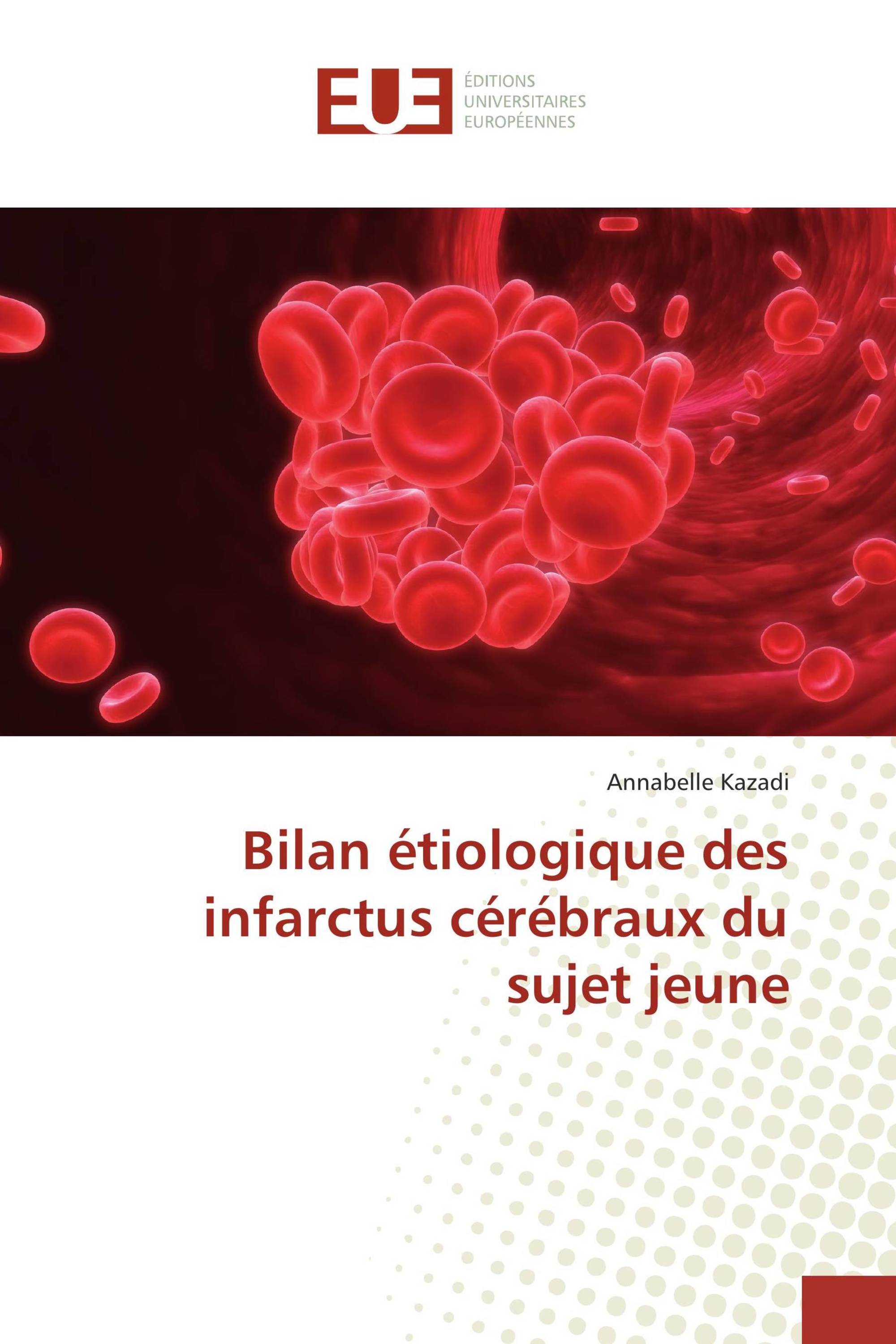 Bilan étiologique des infarctus cérébraux du sujet jeune