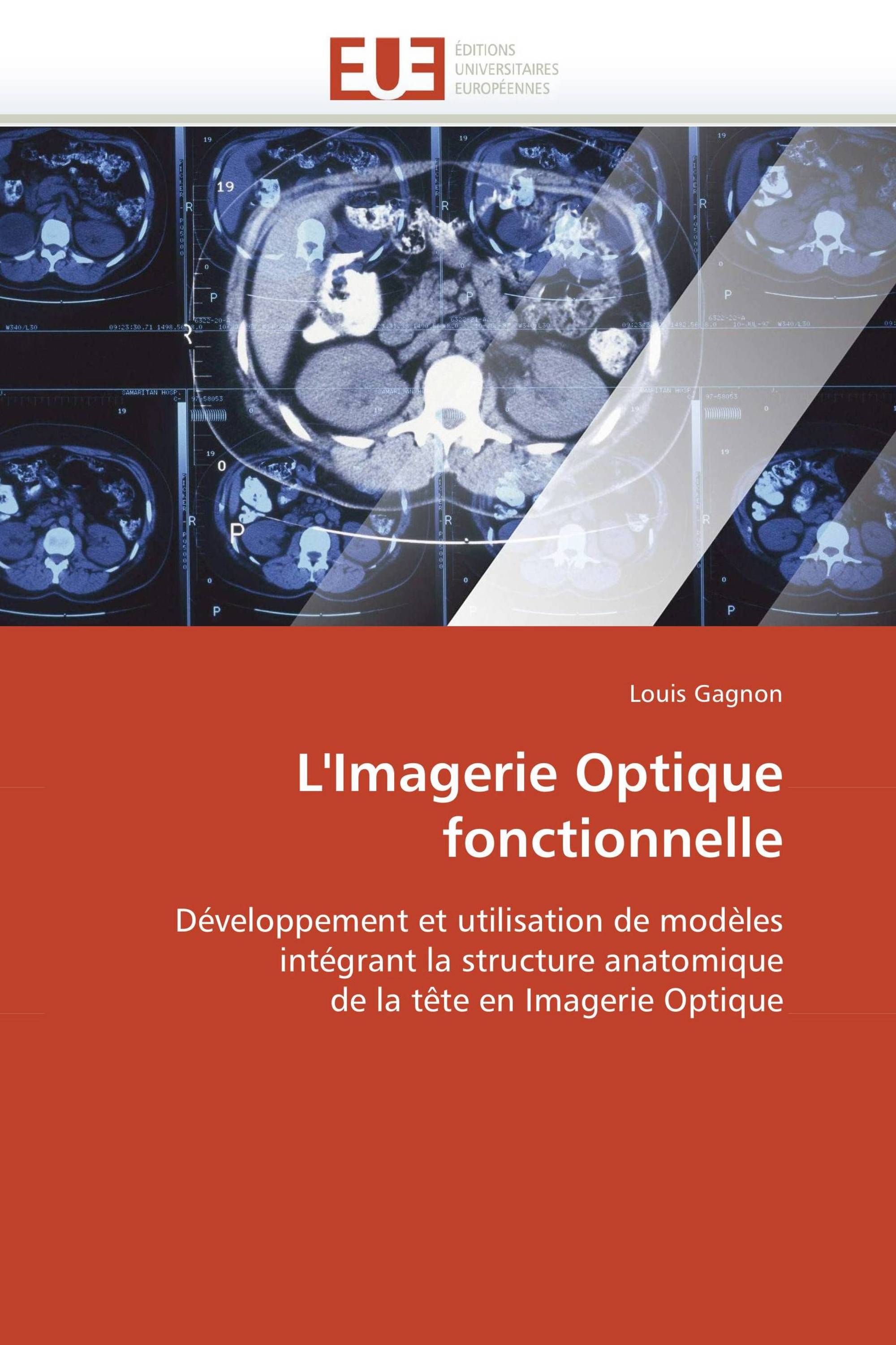 L'Imagerie Optique fonctionnelle