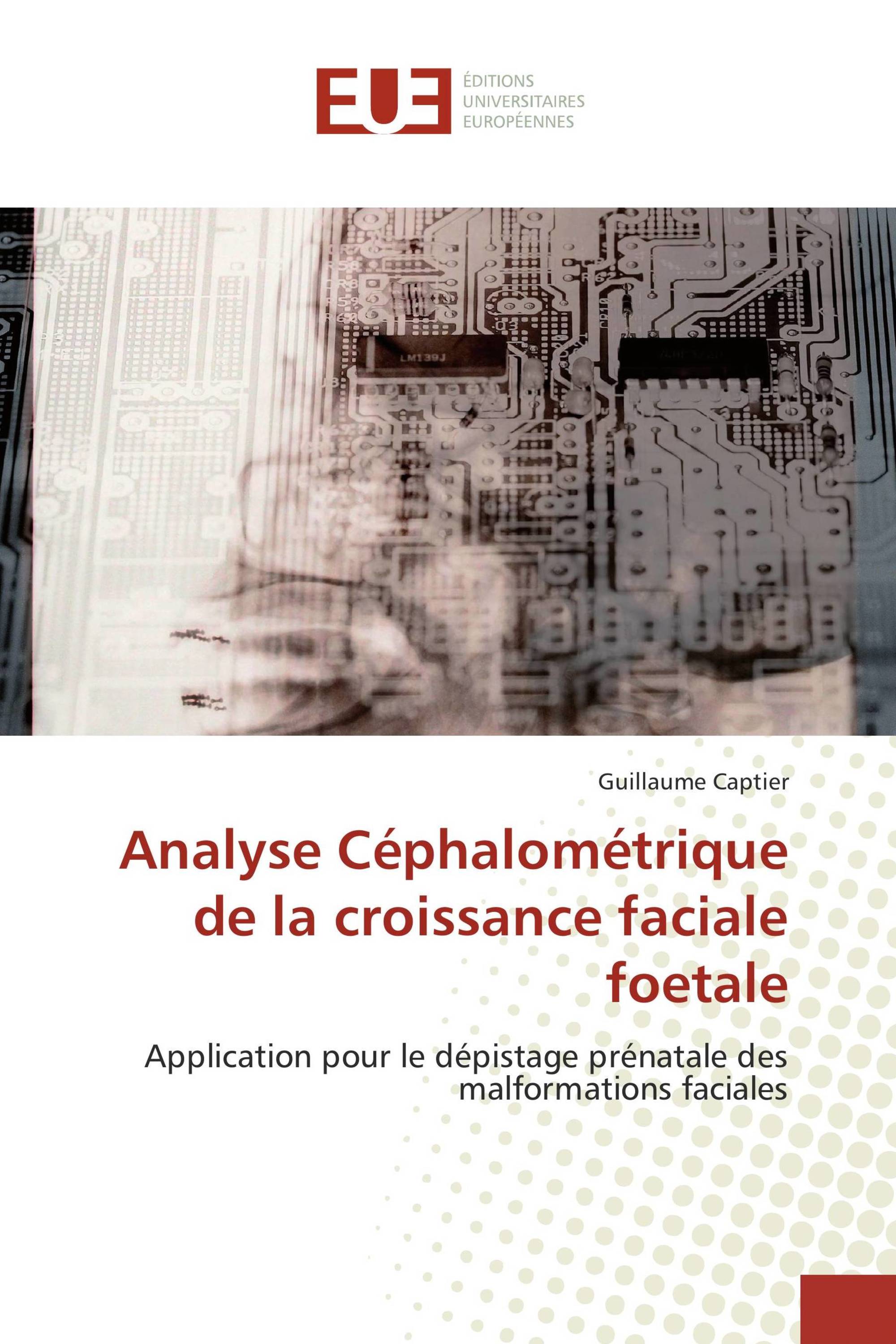 Analyse Céphalométrique de la croissance faciale foetale