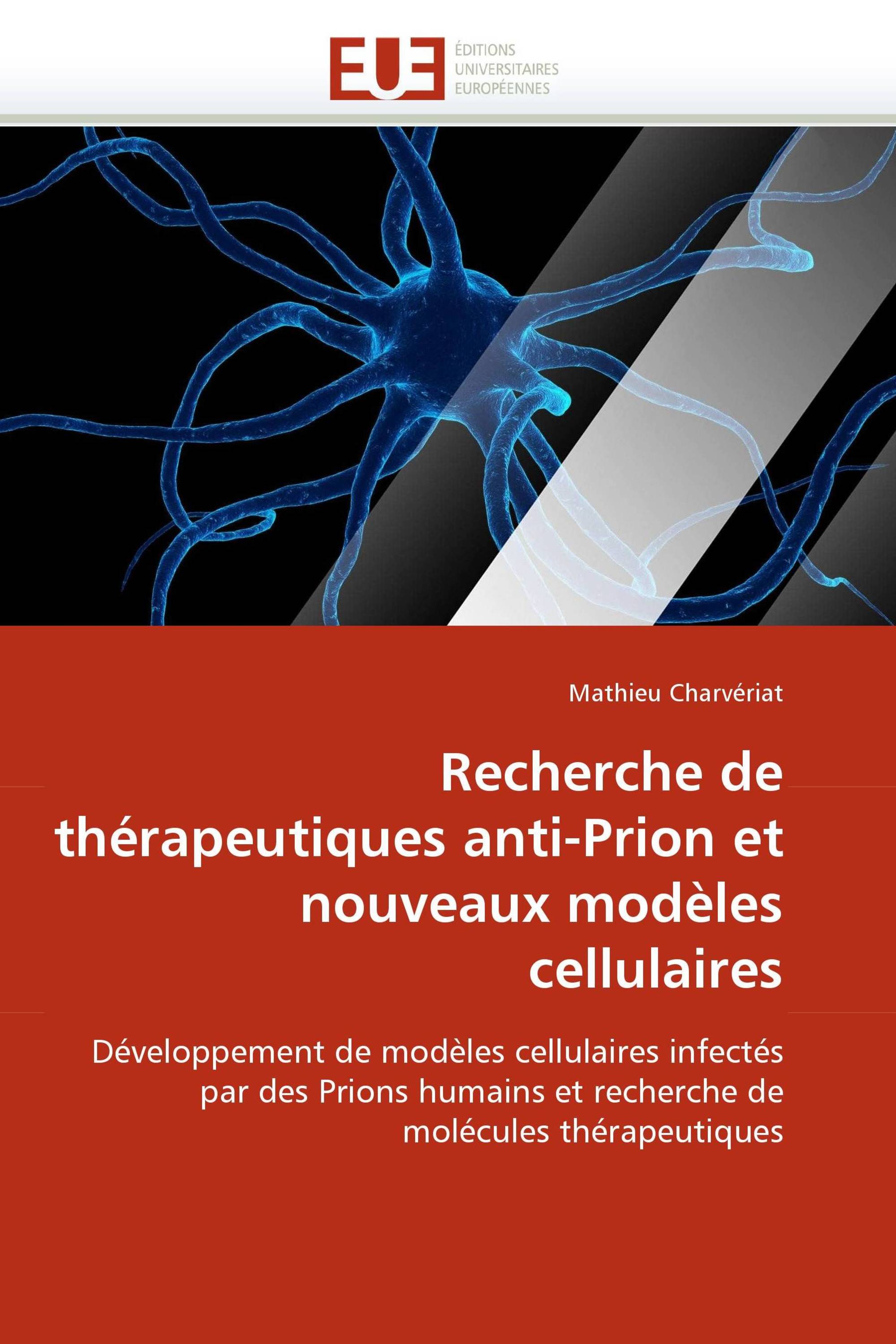 Recherche de thérapeutiques anti-Prion et nouveaux modèles cellulaires