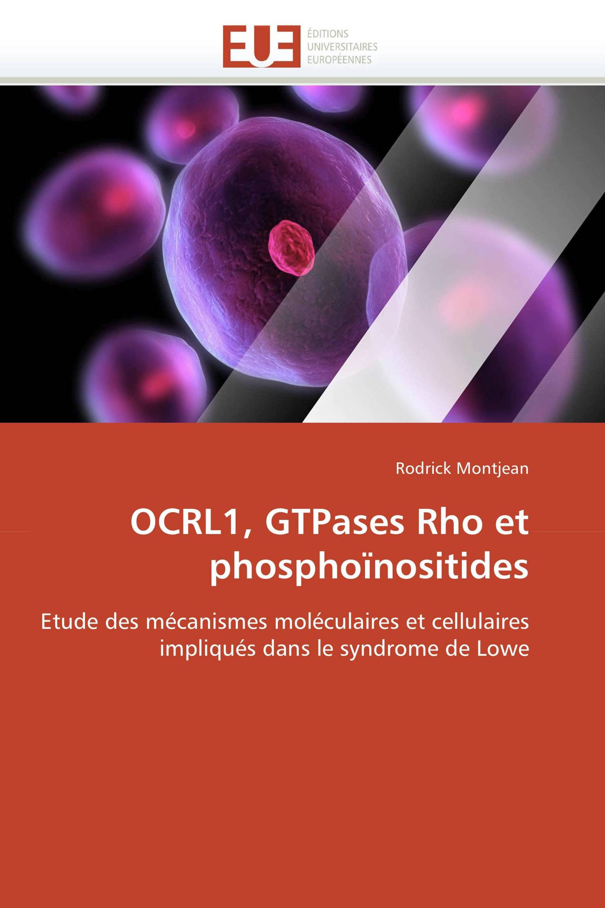 OCRL1, GTPases Rho et phosphoïnositides