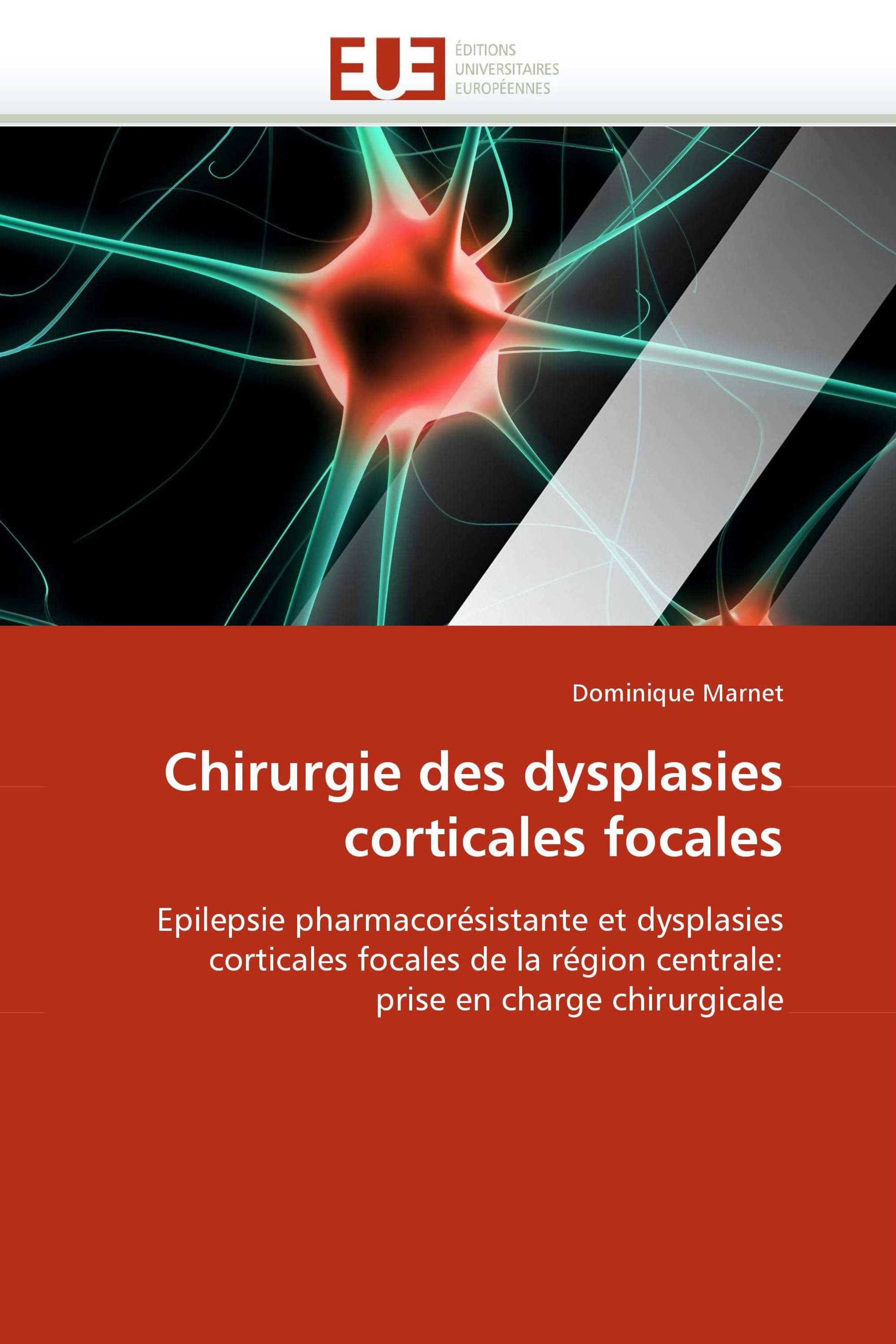 Chirurgie des dysplasies corticales focales