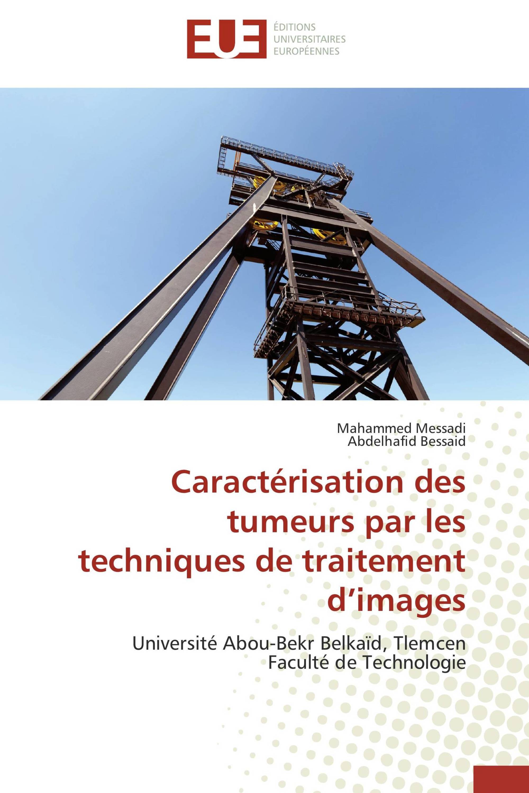 Caractérisation des tumeurs par les techniques de traitement d’images