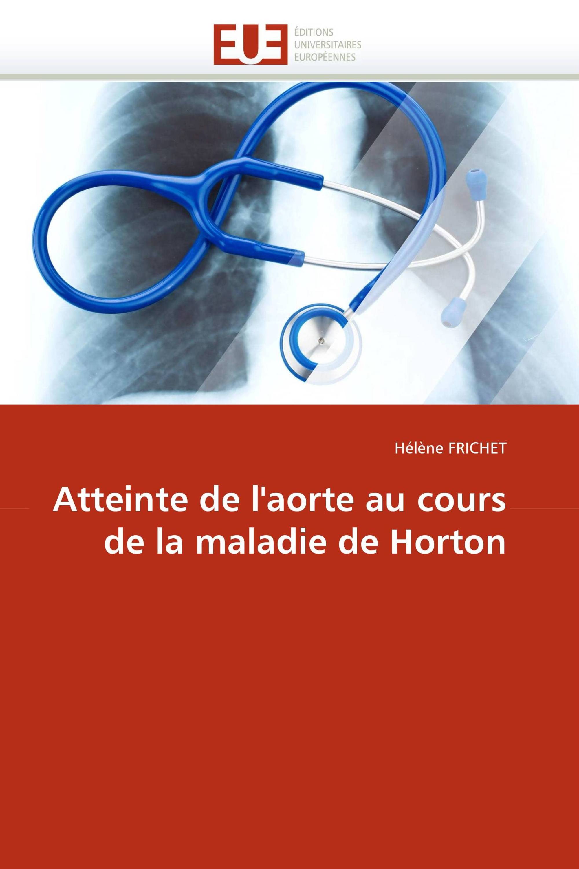 Atteinte de l'aorte au cours de la maladie de Horton