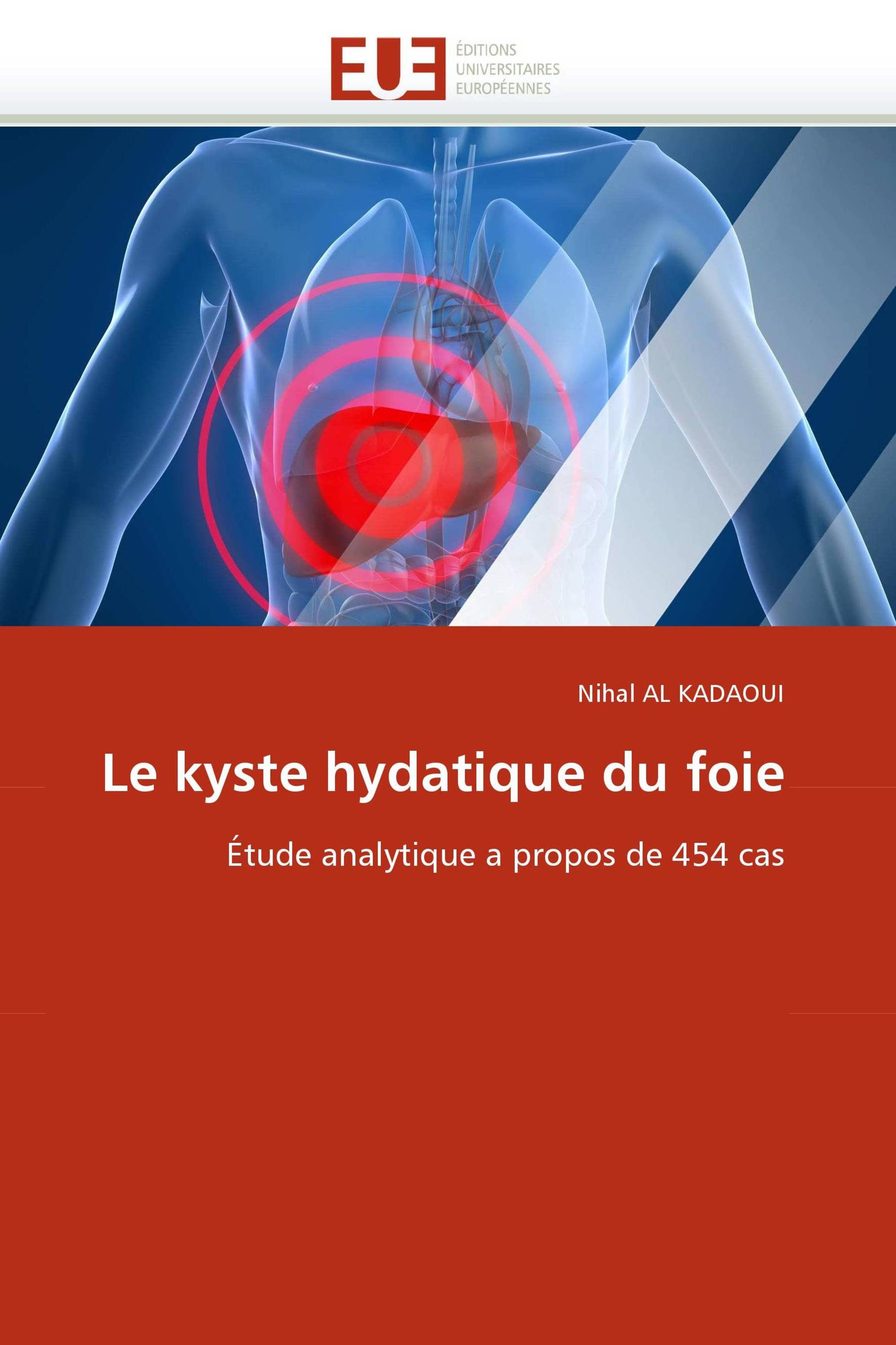 Le kyste hydatique du foie