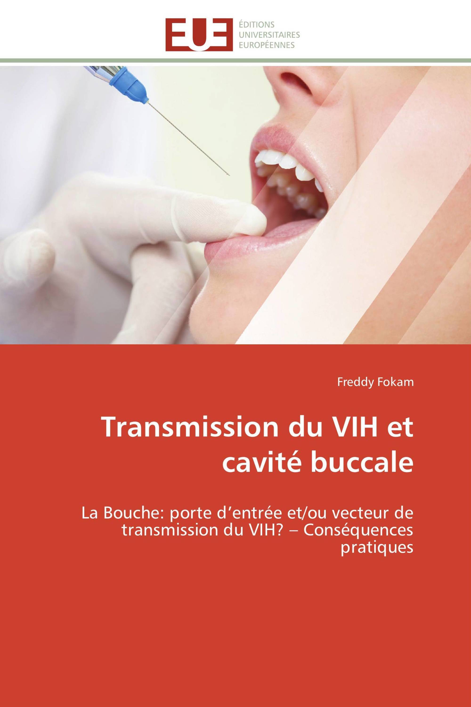 Transmission du VIH et cavité buccale