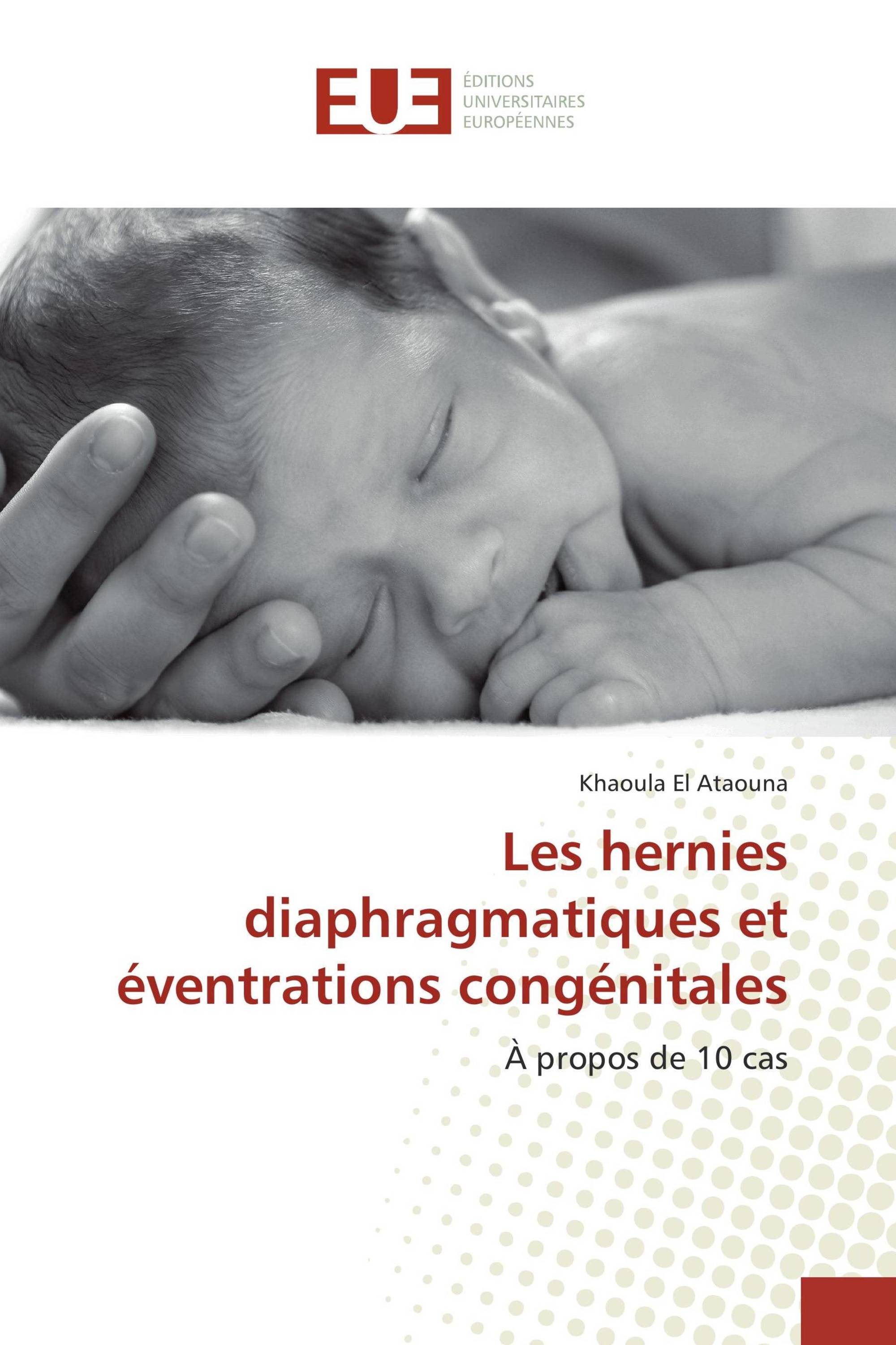 Les hernies diaphragmatiques et éventrations congénitales