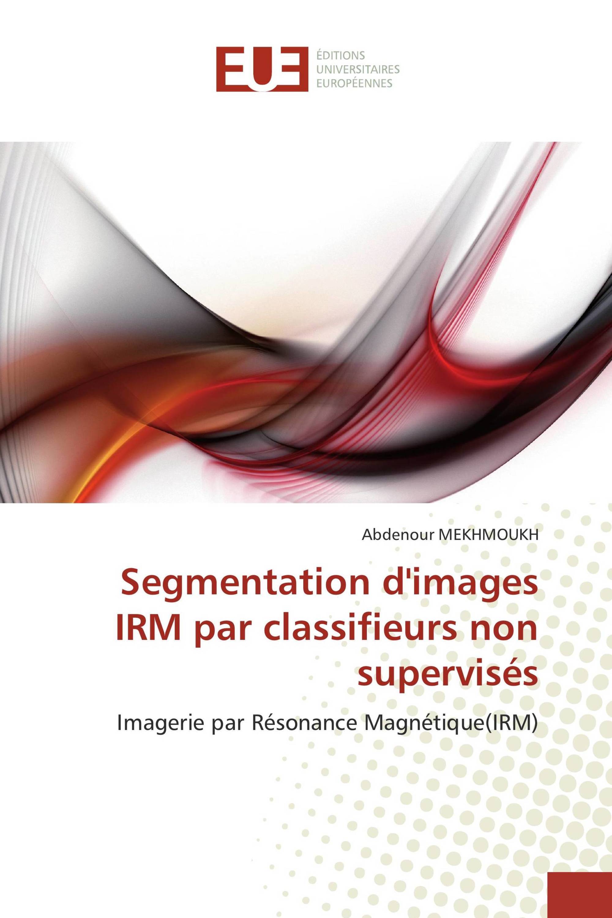 Segmentation d'images IRM par classifieurs non supervisés