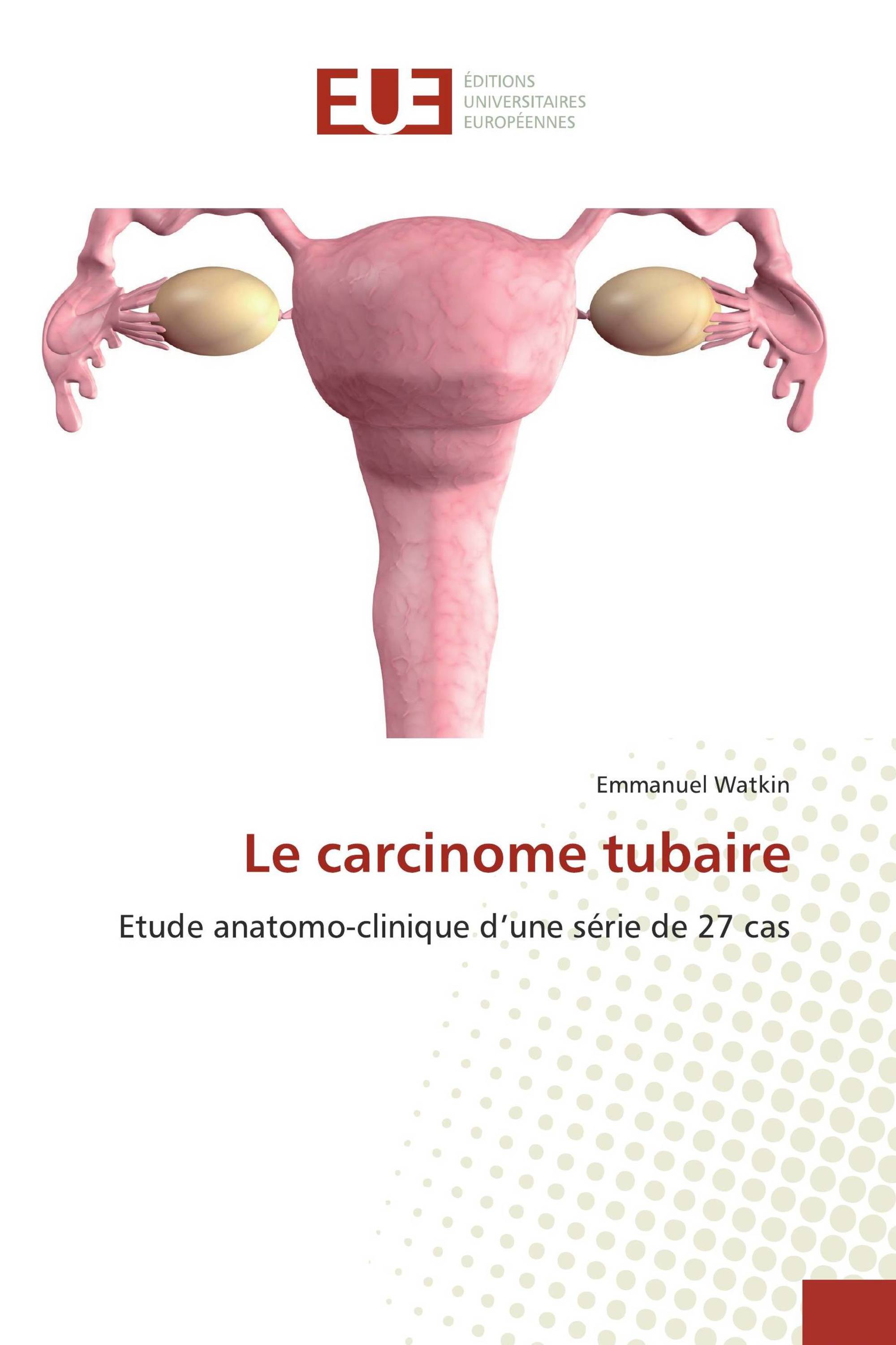 Le carcinome tubaire