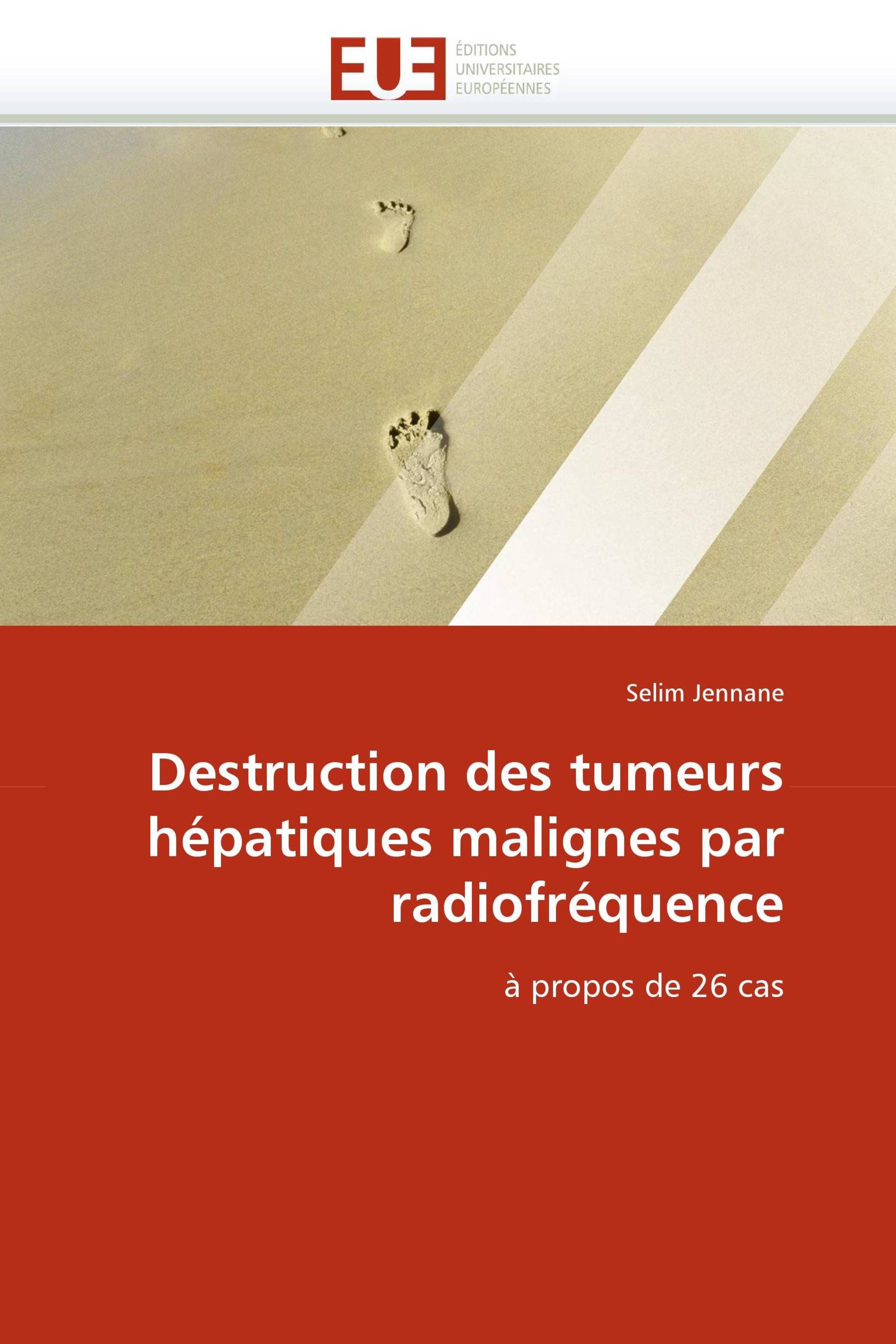 Destruction des tumeurs hépatiques malignes par radiofréquence