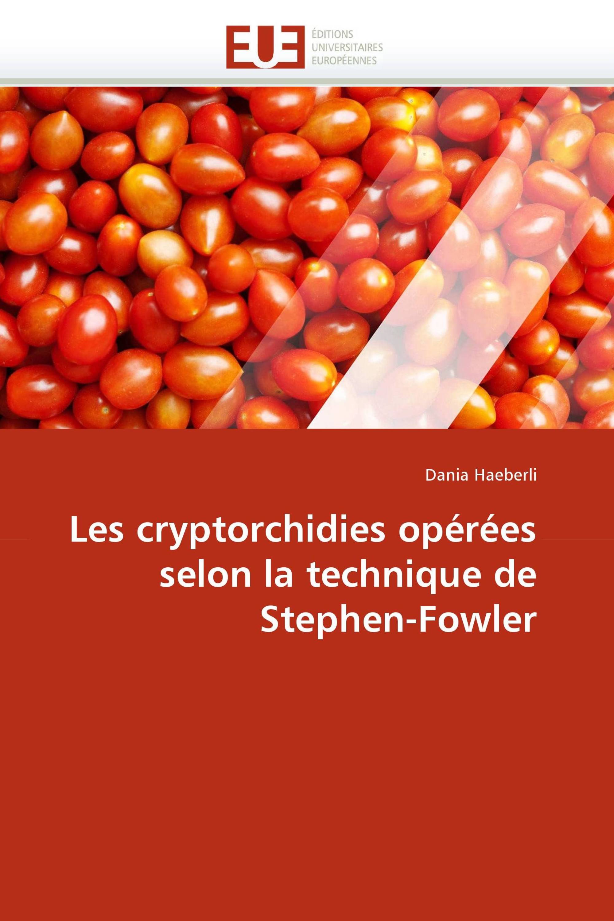 Les cryptorchidies opérées selon la technique de Stephen-Fowler