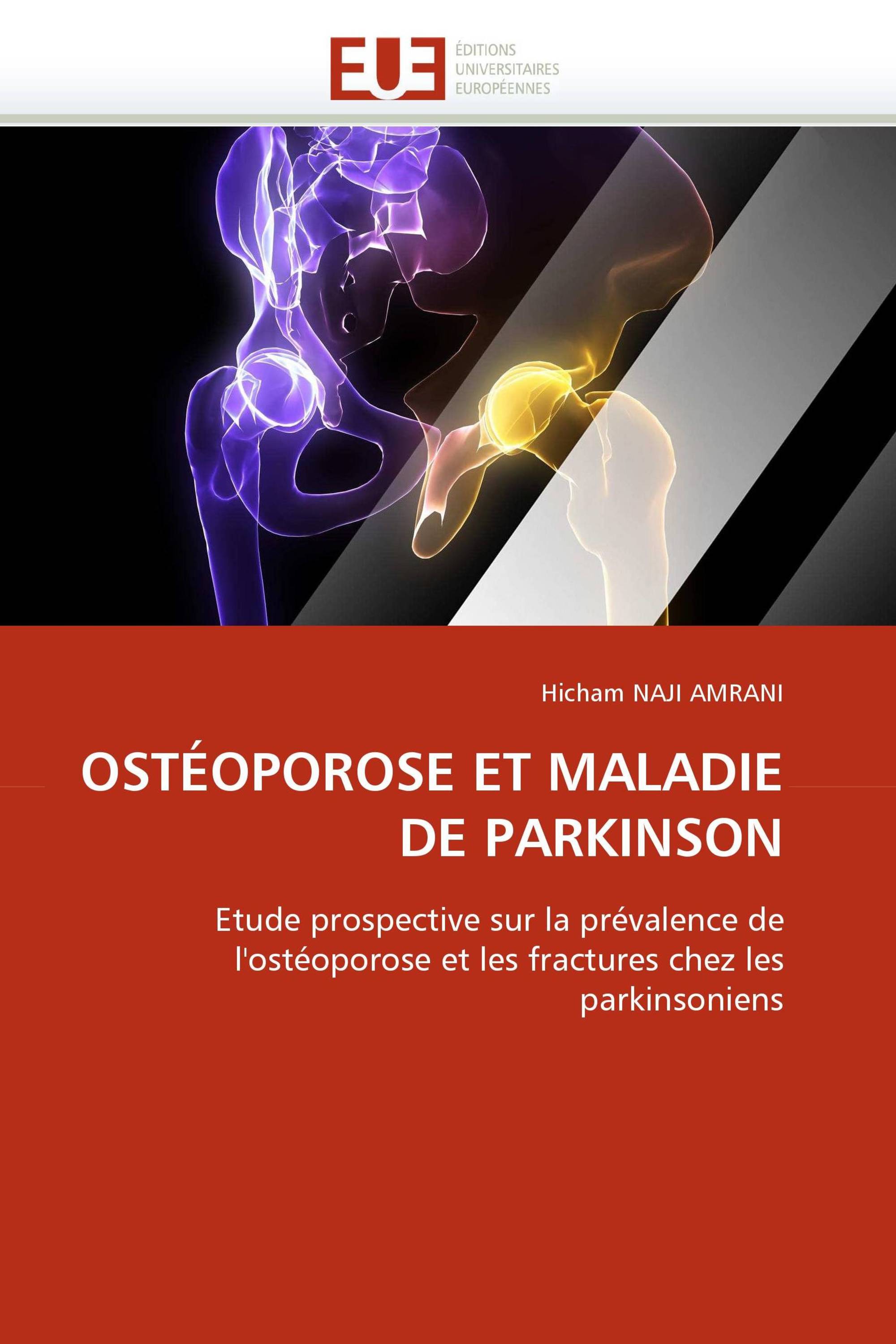 OSTÉOPOROSE ET MALADIE DE PARKINSON