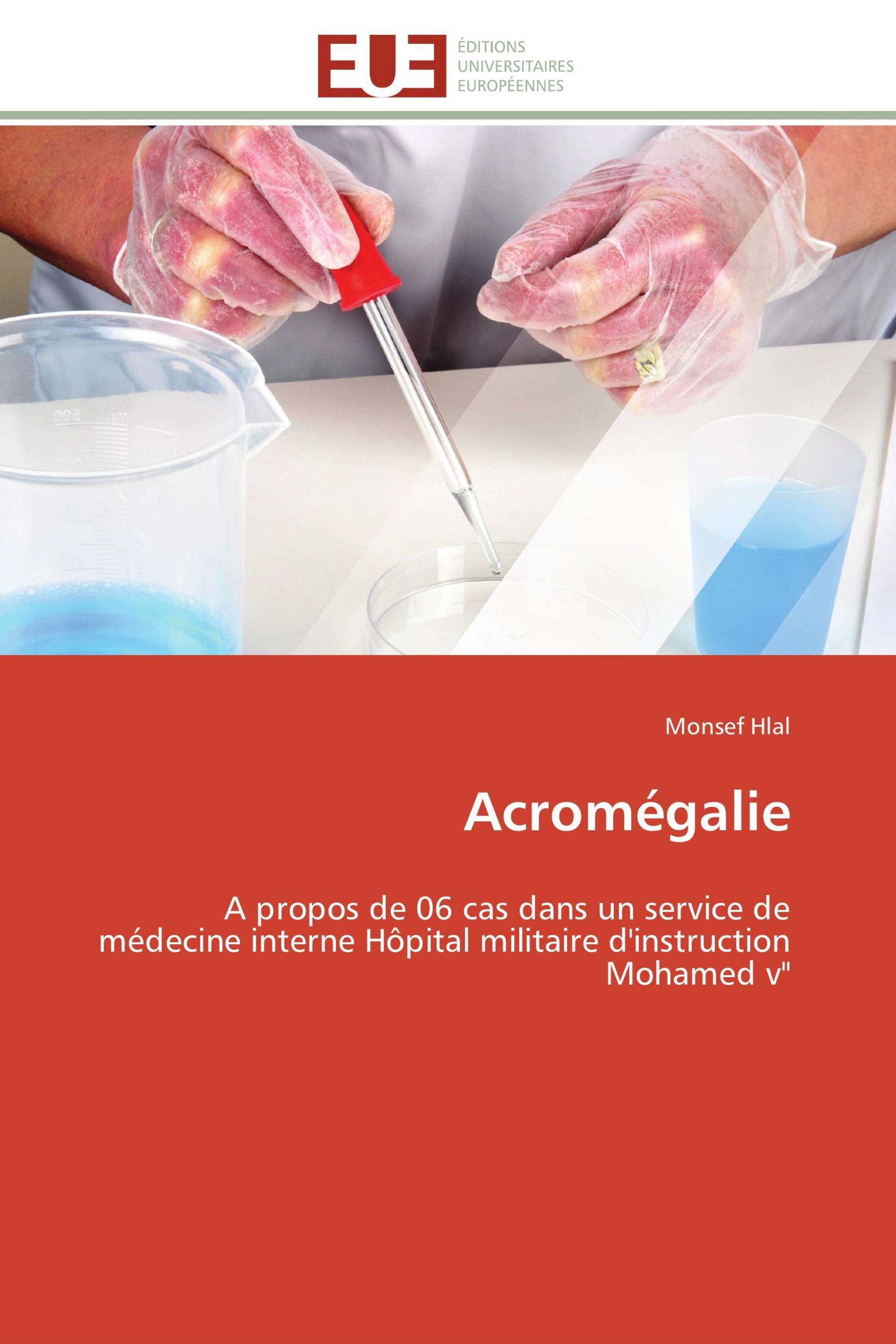 Acromégalie