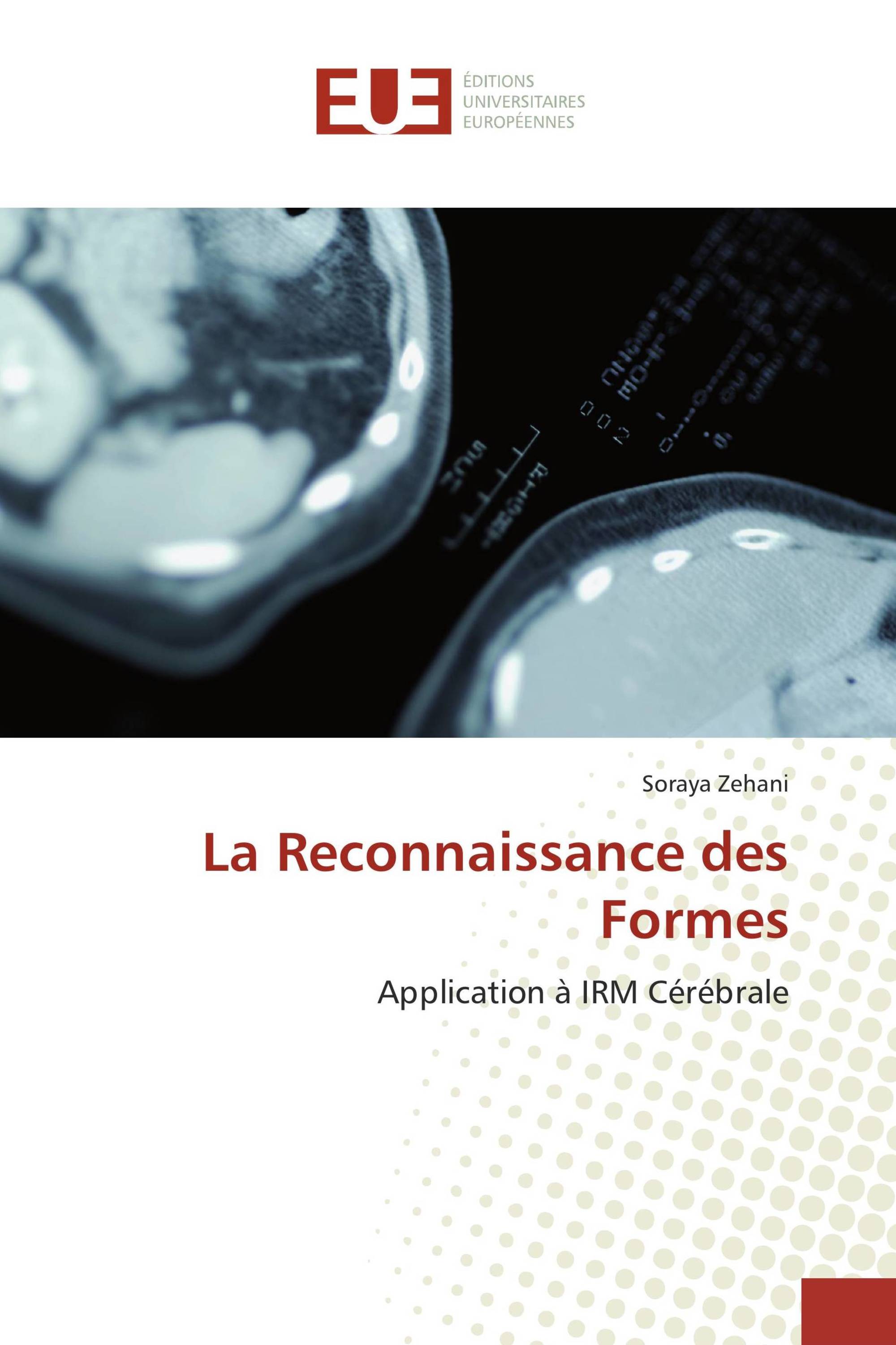 La Reconnaissance des Formes