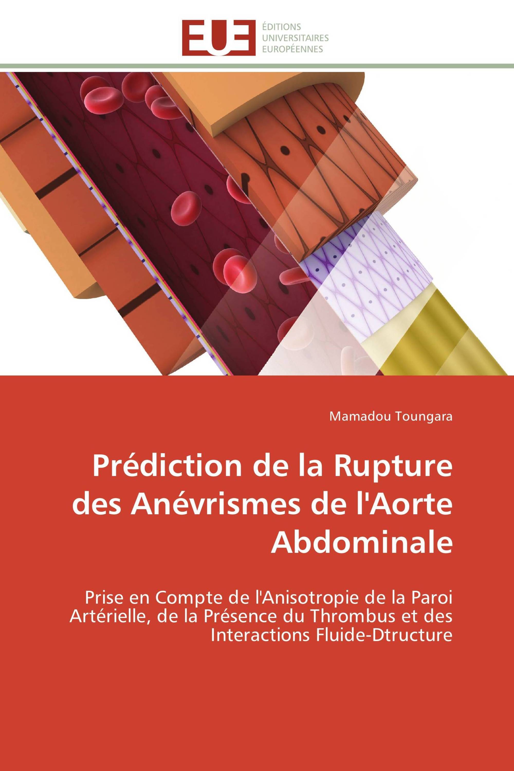 Prédiction de la Rupture des Anévrismes de l'Aorte Abdominale