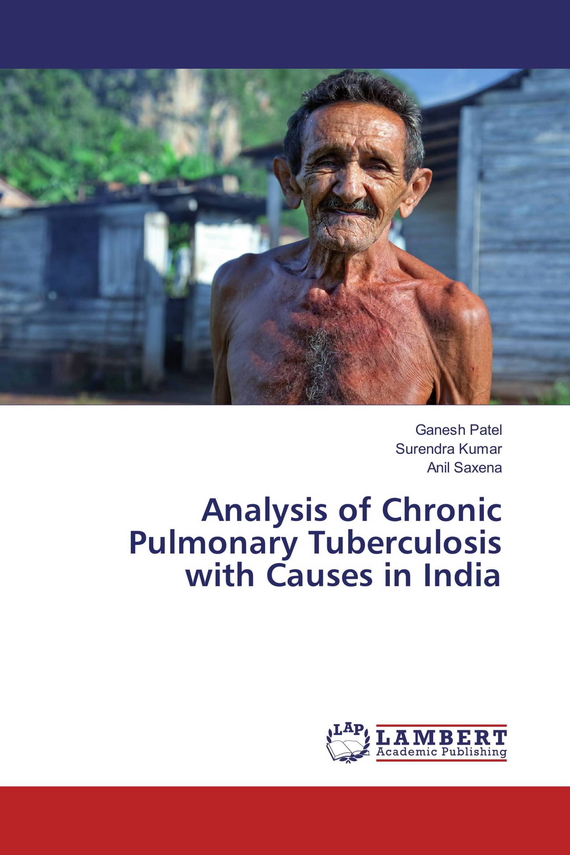 Analysis of Chronic Pulmonary Tuberculosis with Causes in India