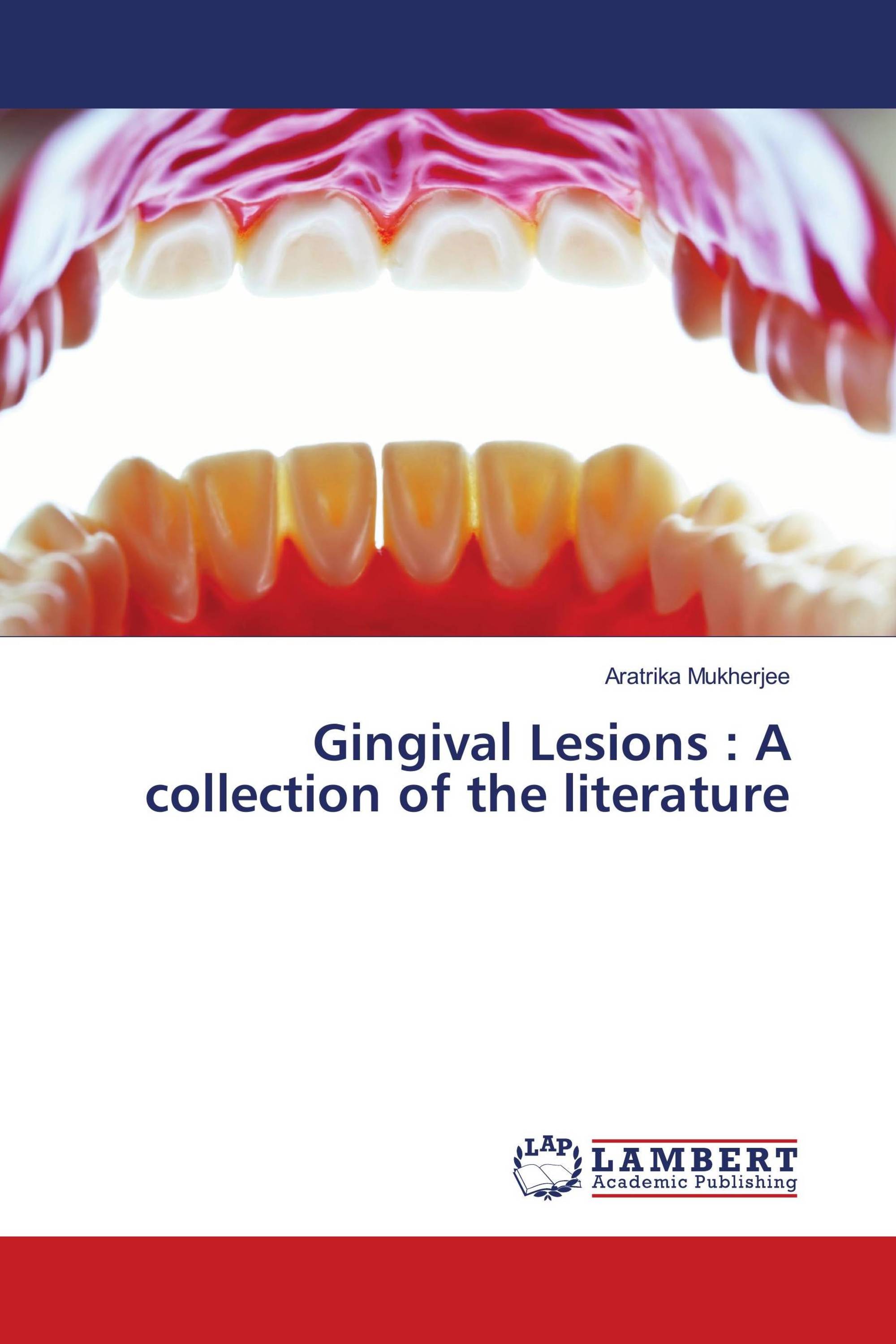 Gingival Lesions : A collection of the literature