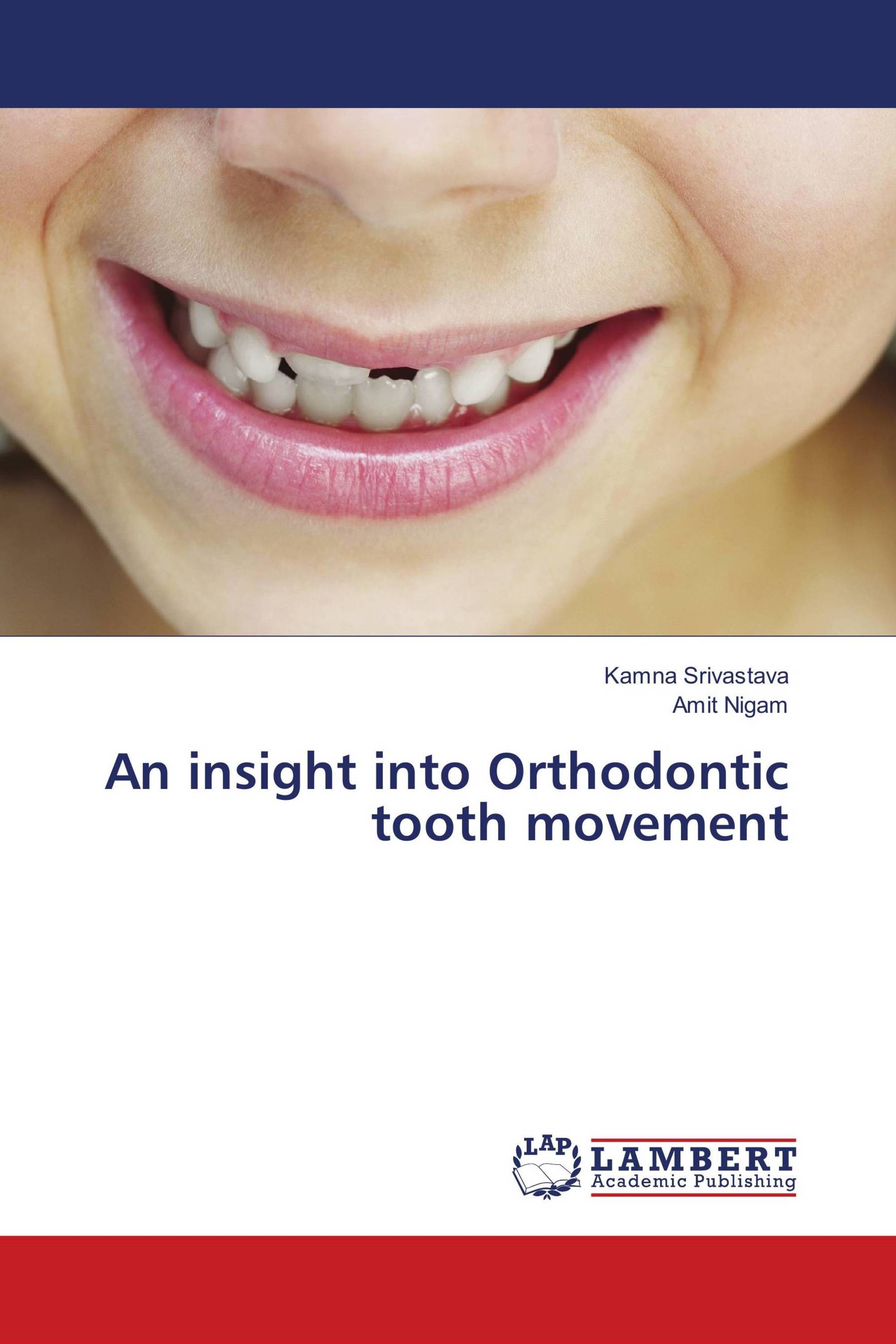 An insight into Orthodontic tooth movement