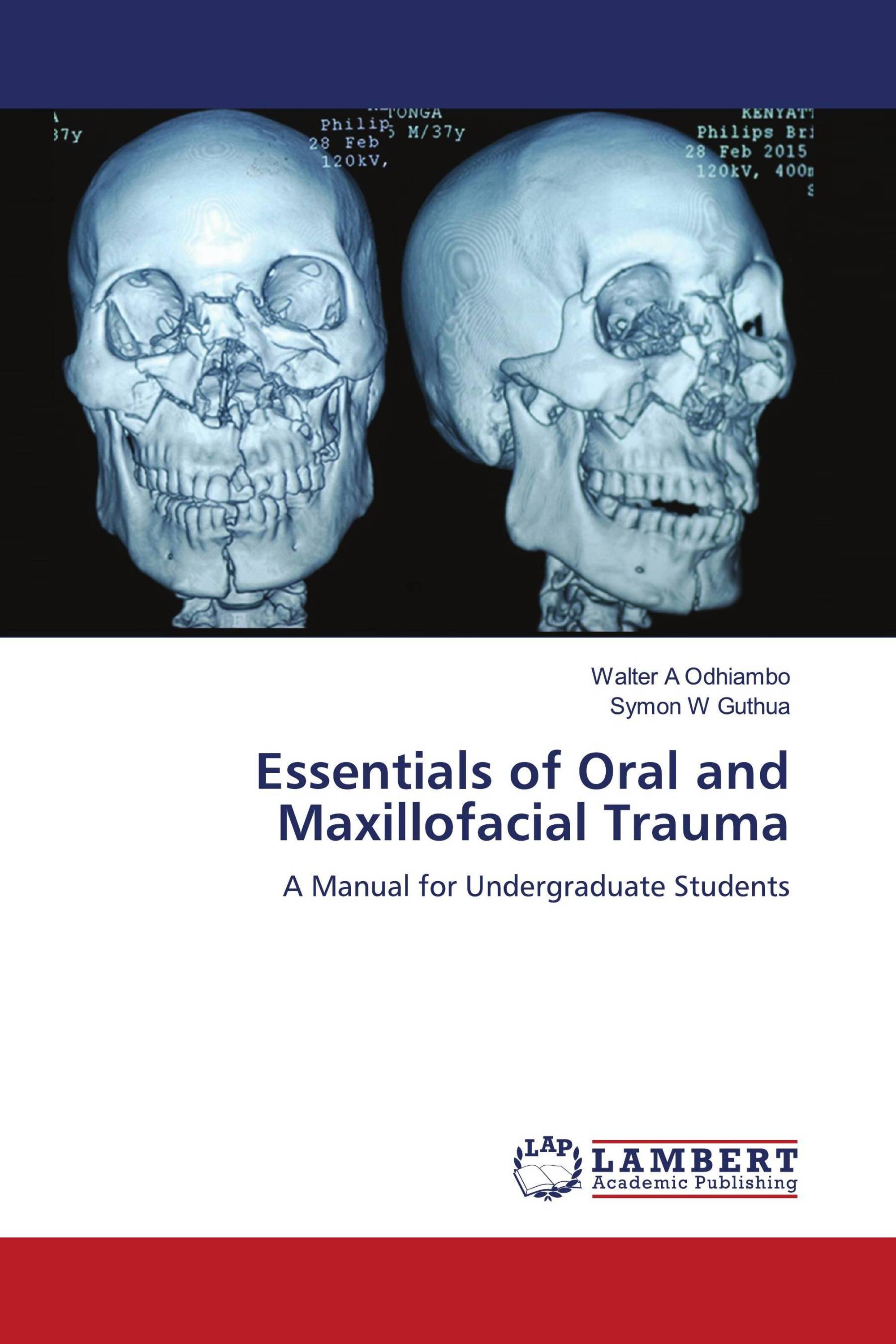 Essentials of Oral and Maxillofacial Trauma