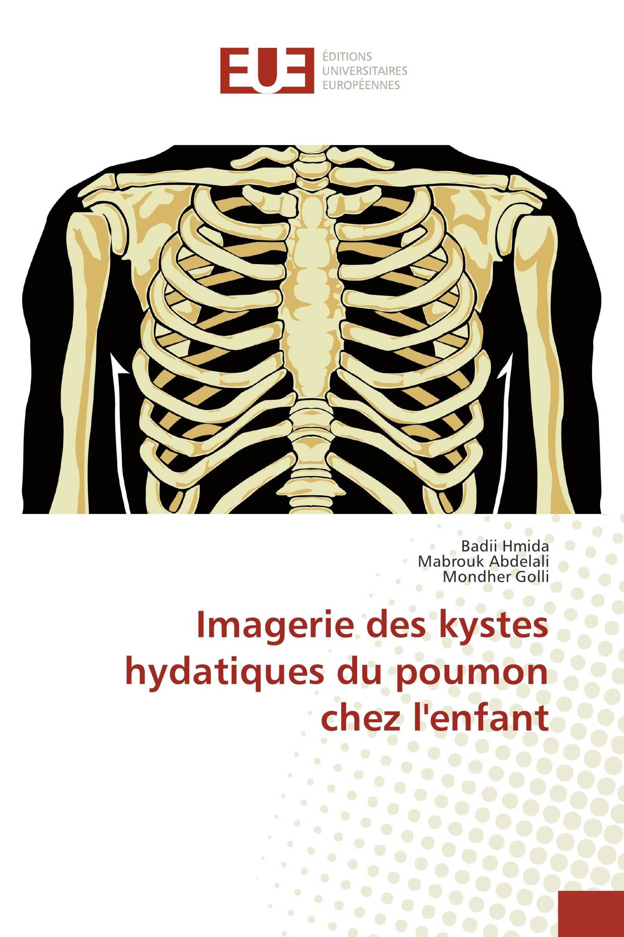 Imagerie des kystes hydatiques du poumon chez l'enfant