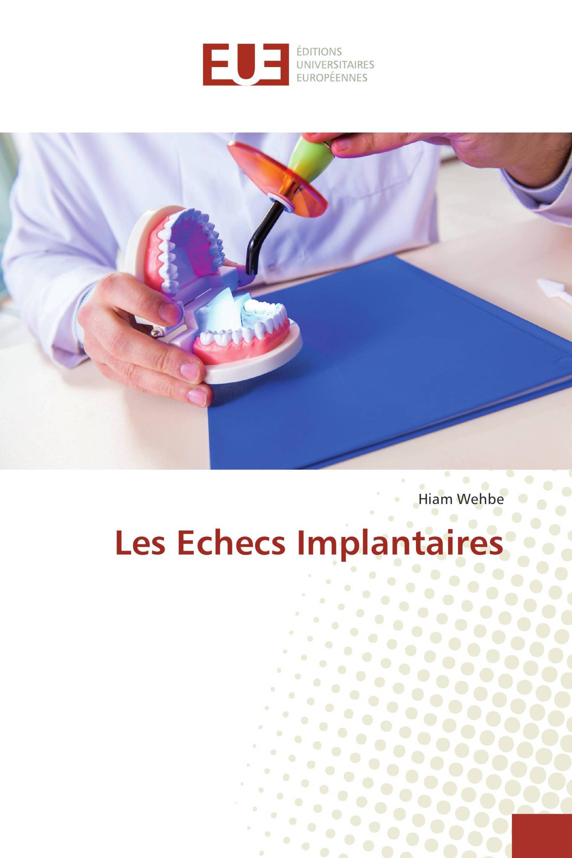 Les Echecs Implantaires