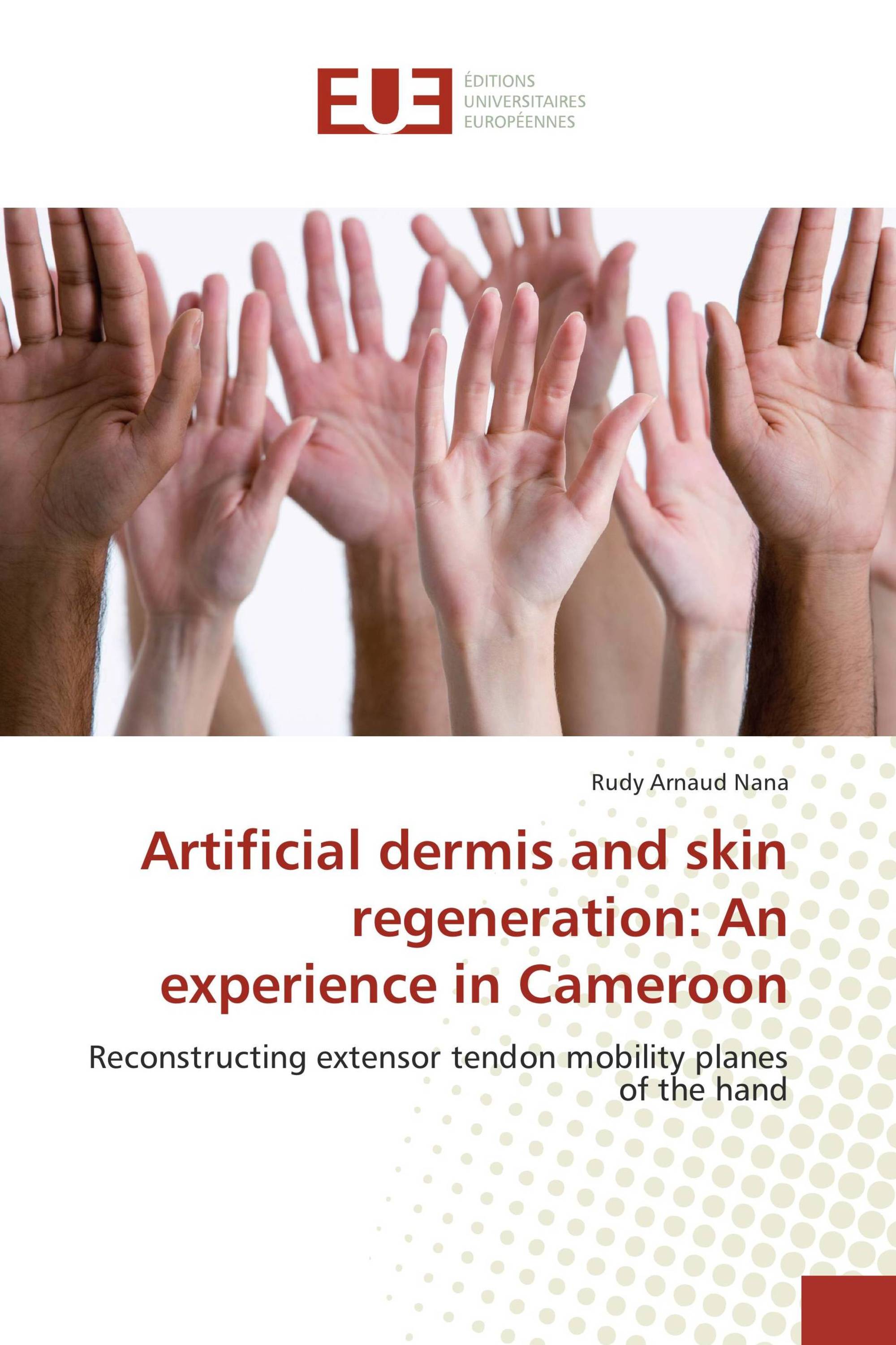 Artificial dermis and skin regeneration: An experience in Cameroon