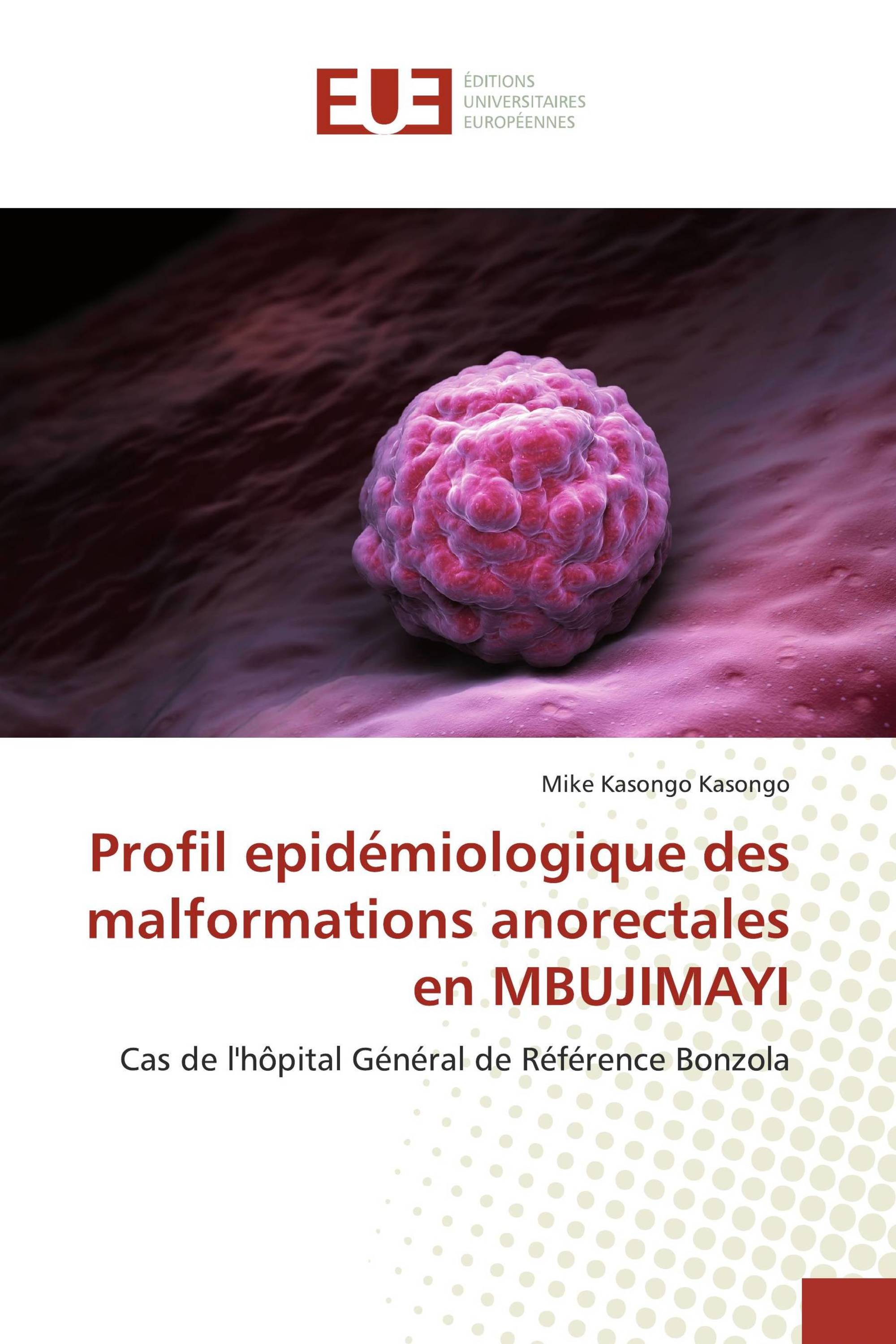 Profil epidémiologique des malformations anorectales en MBUJIMAYI