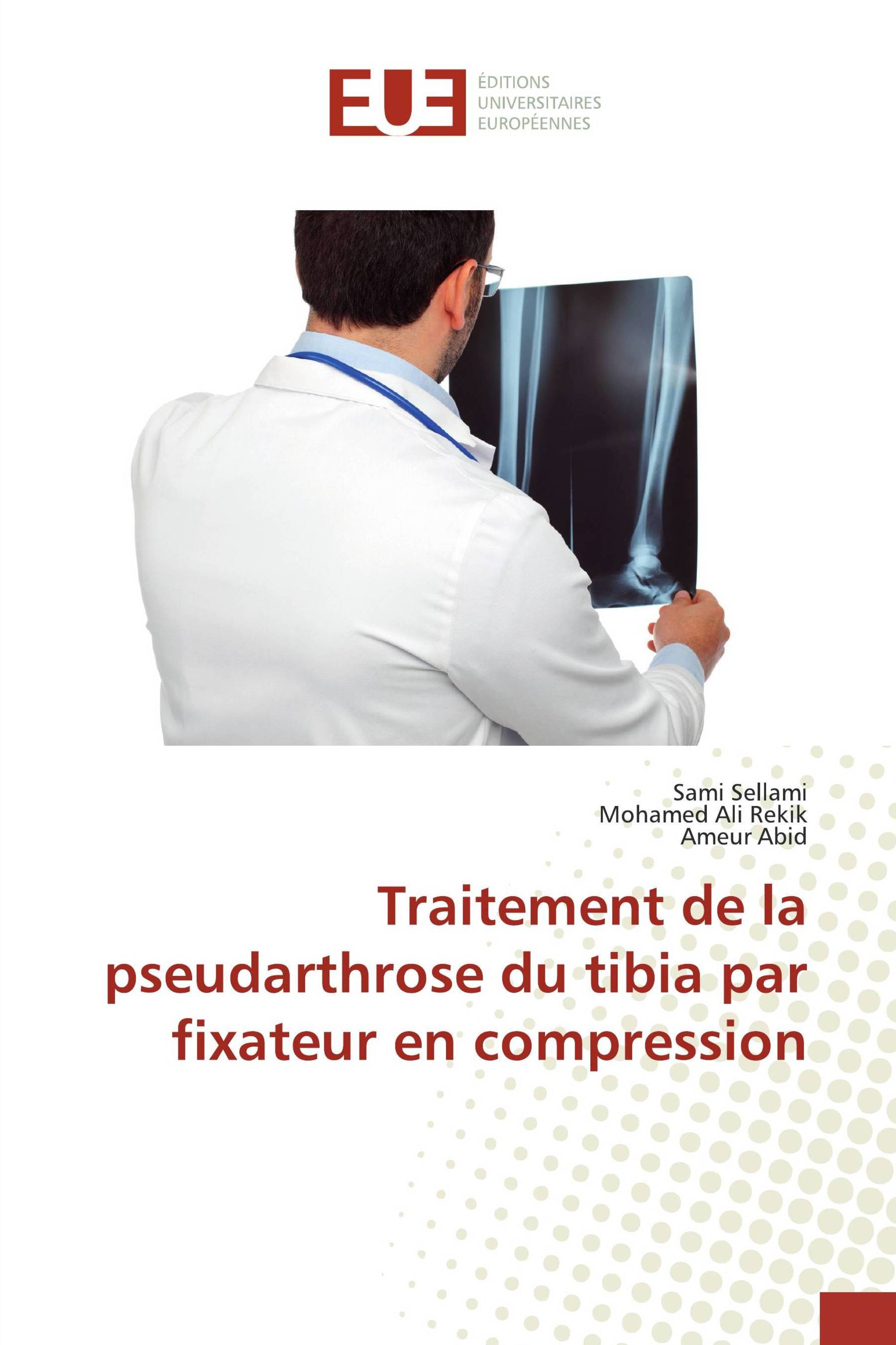 Traitement de la pseudarthrose du tibia par fixateur en compression