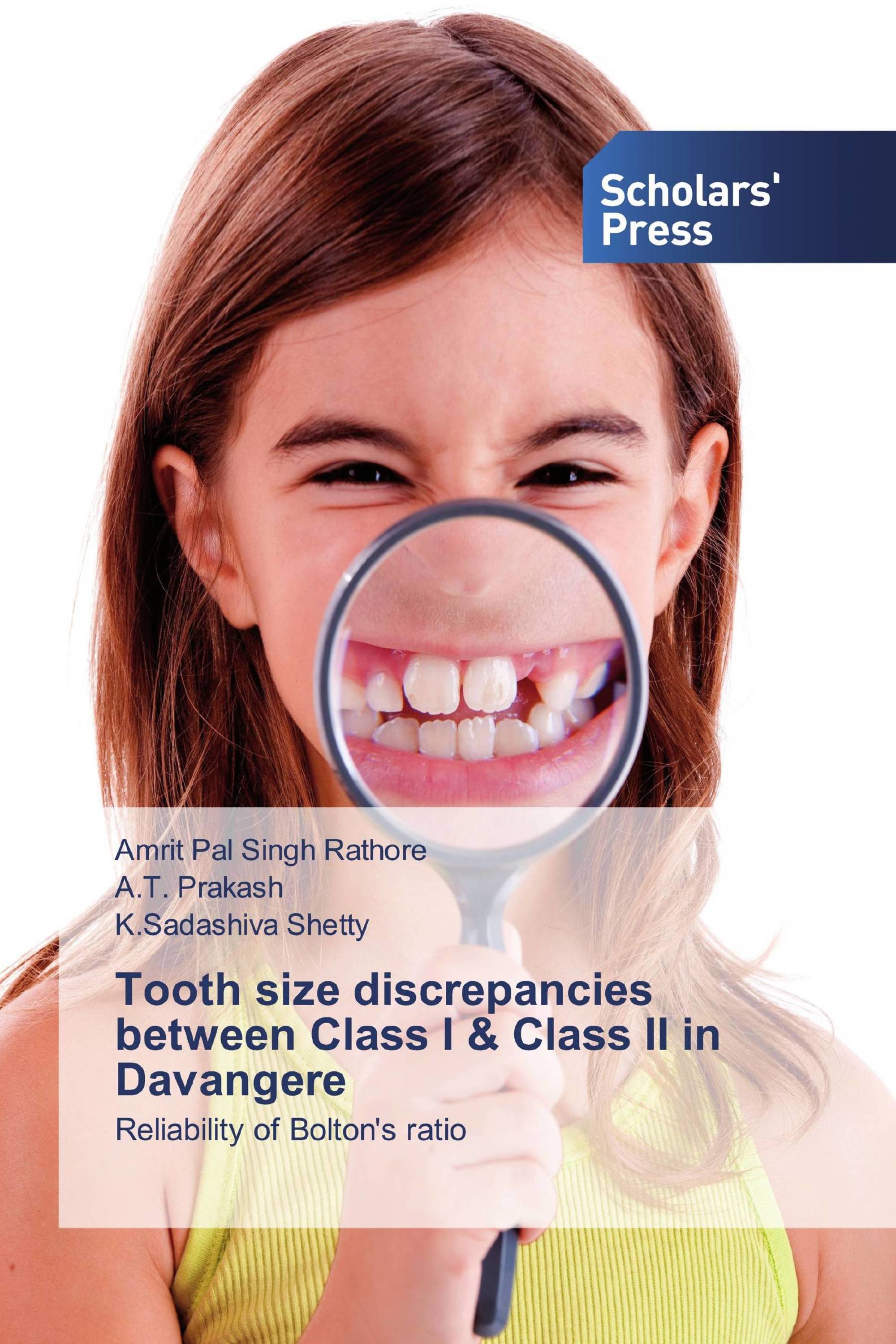 Tooth size discrepancies between Class I & Class II in Davangere