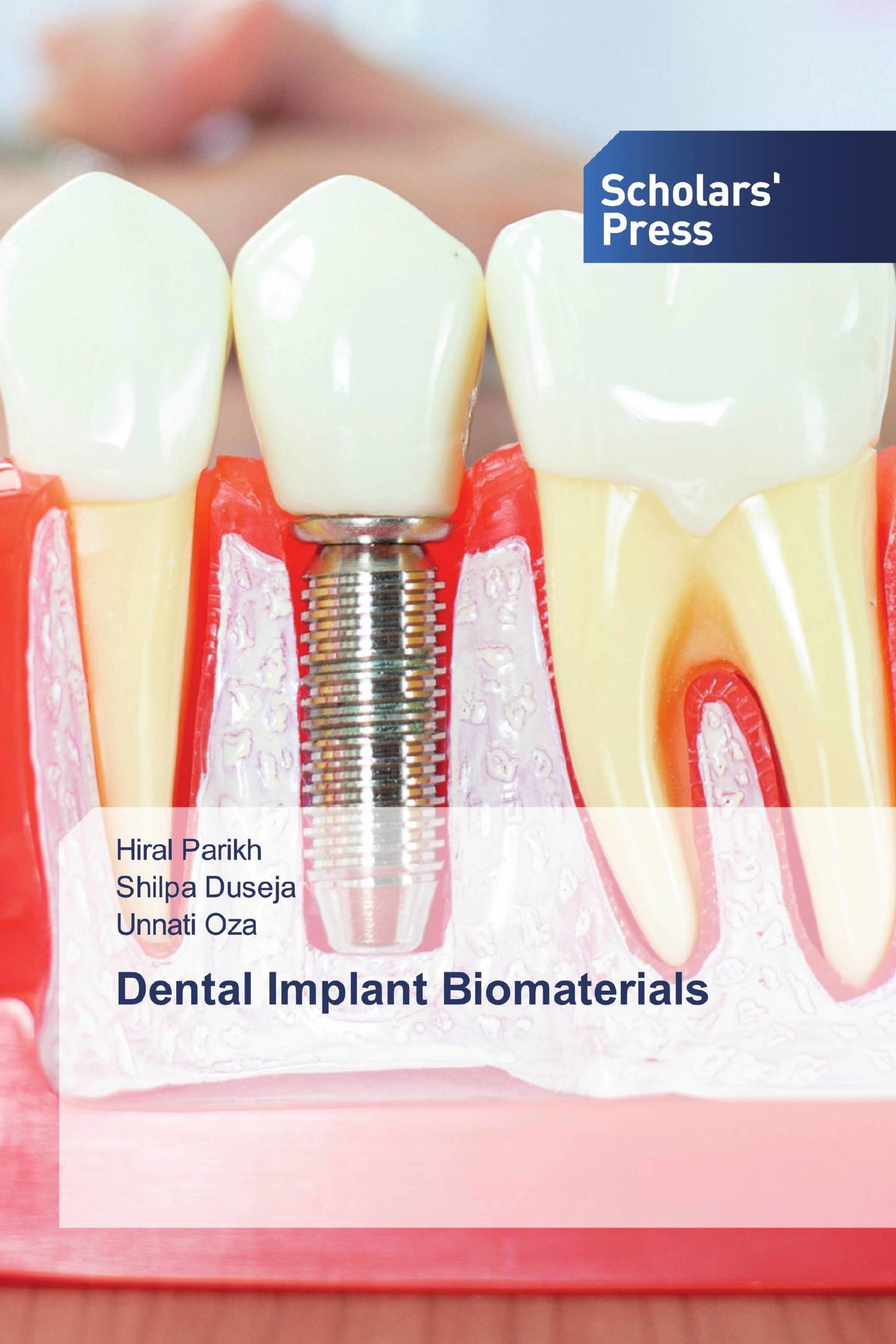 Dental Implant Biomaterials