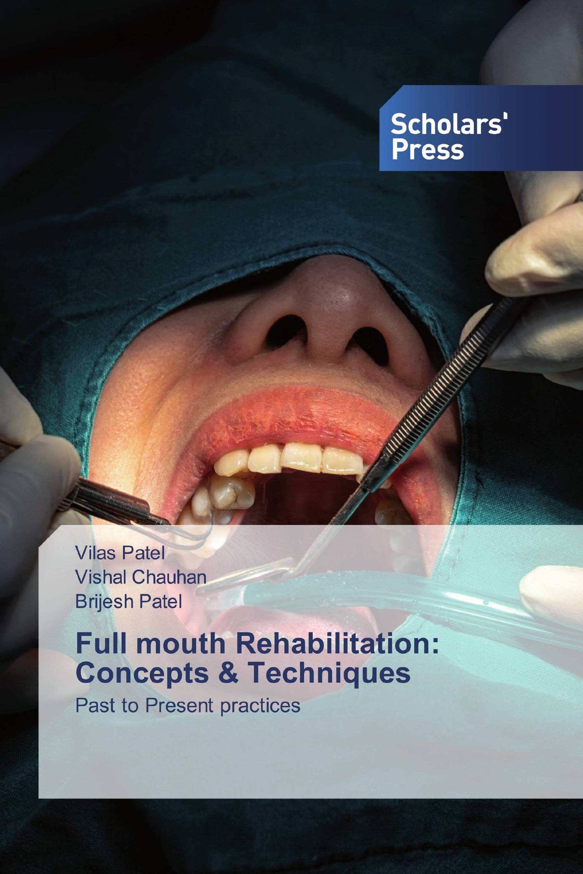 Full mouth Rehabilitation: Concepts & Techniques