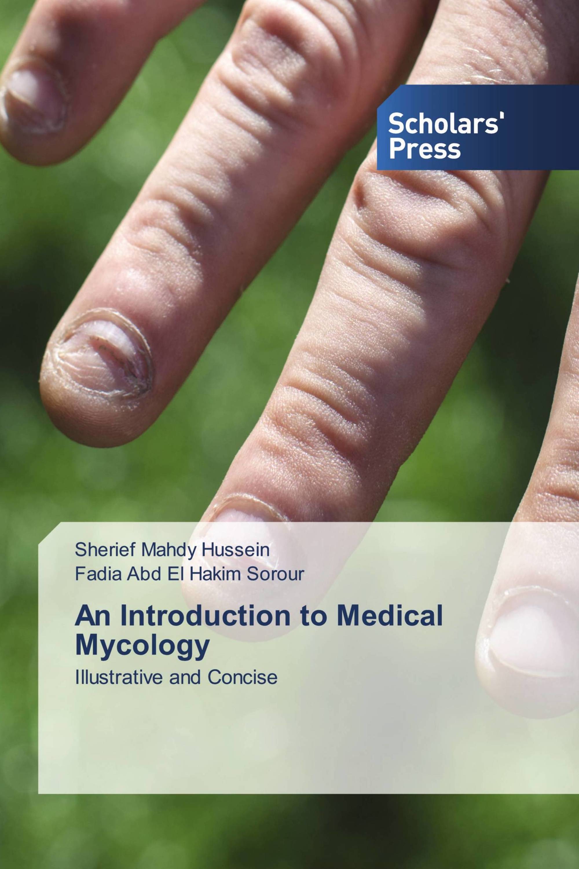 An Introduction to Medical Mycology