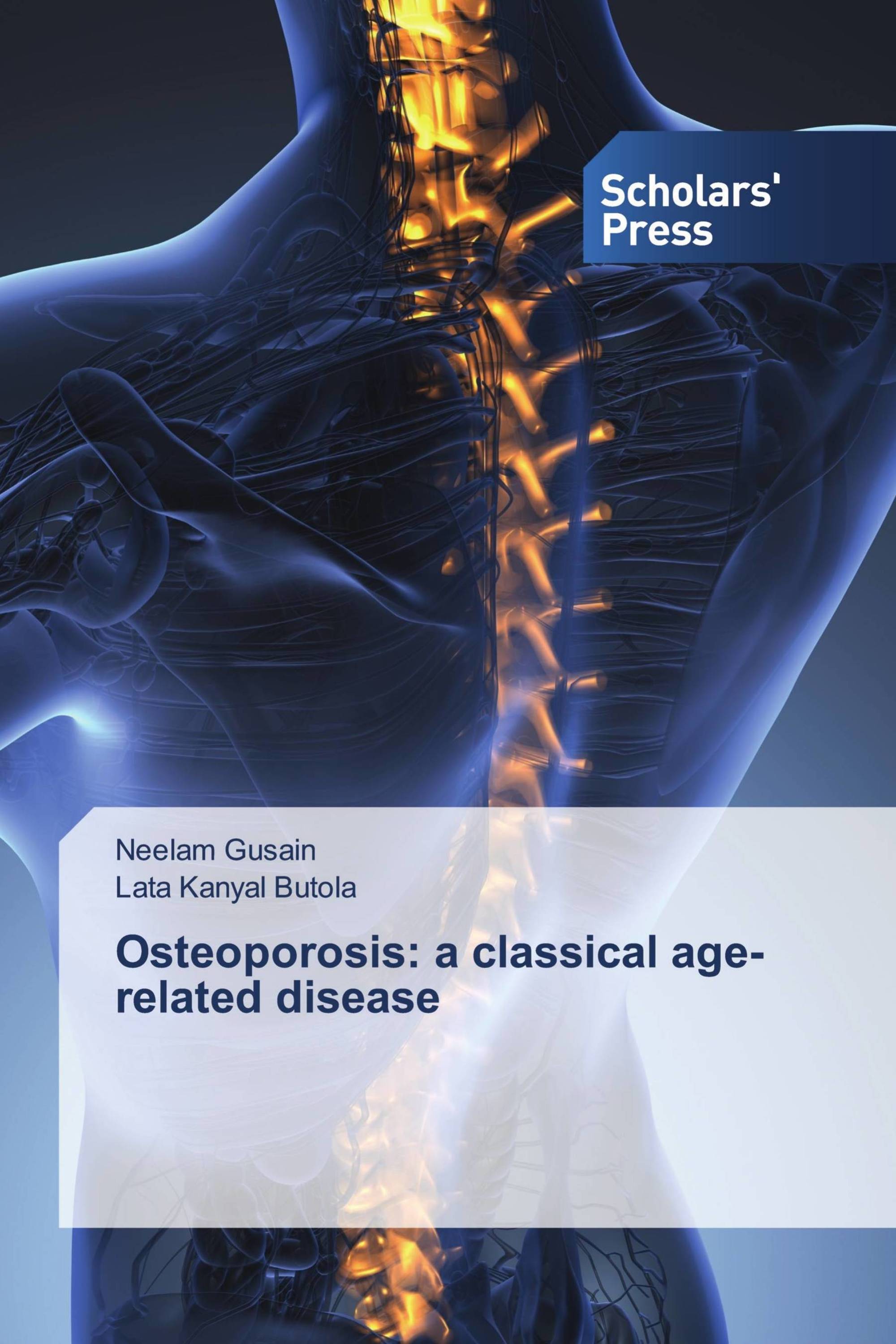 Osteoporosis: a classical age-related disease