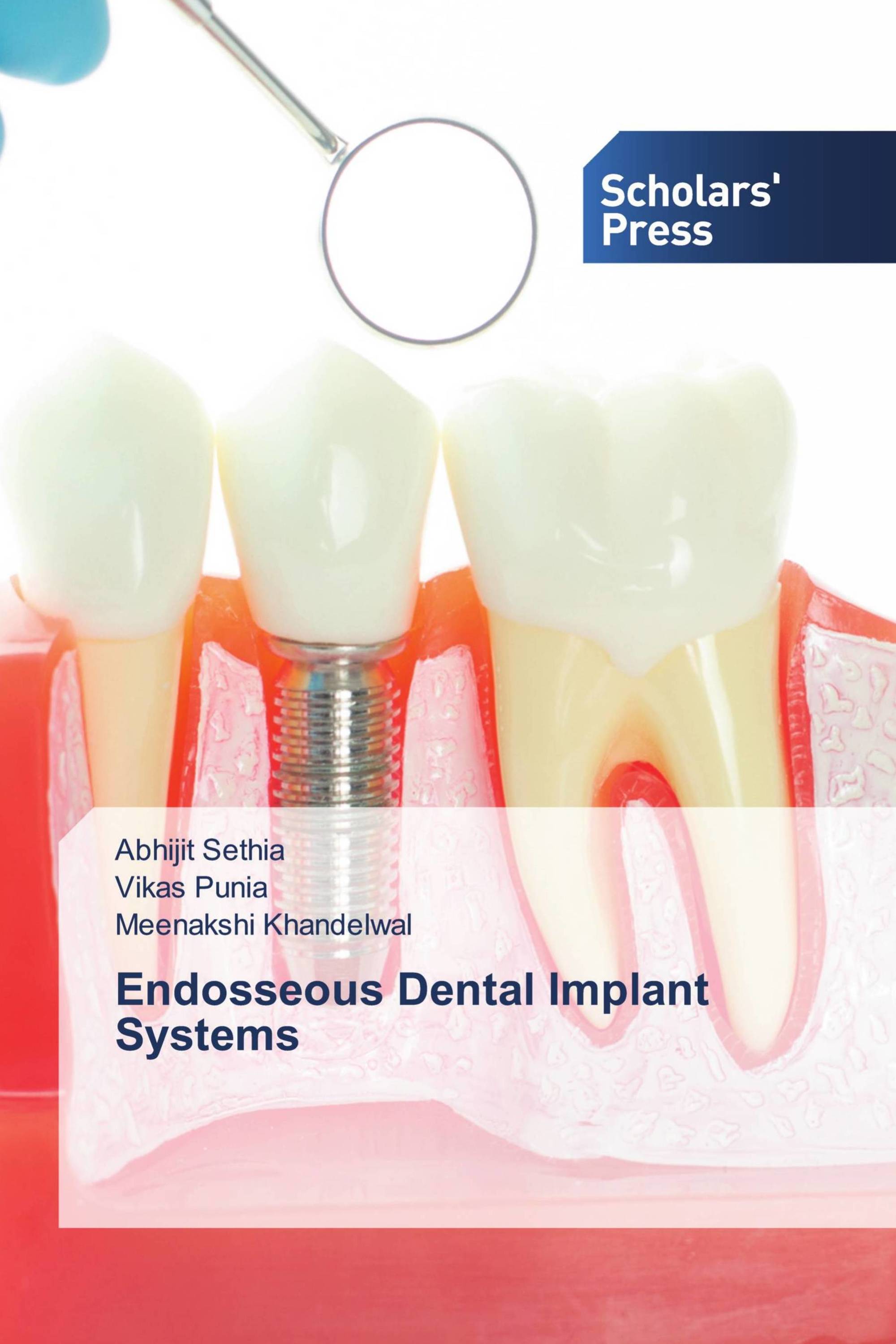 Endosseous Dental Implant Systems